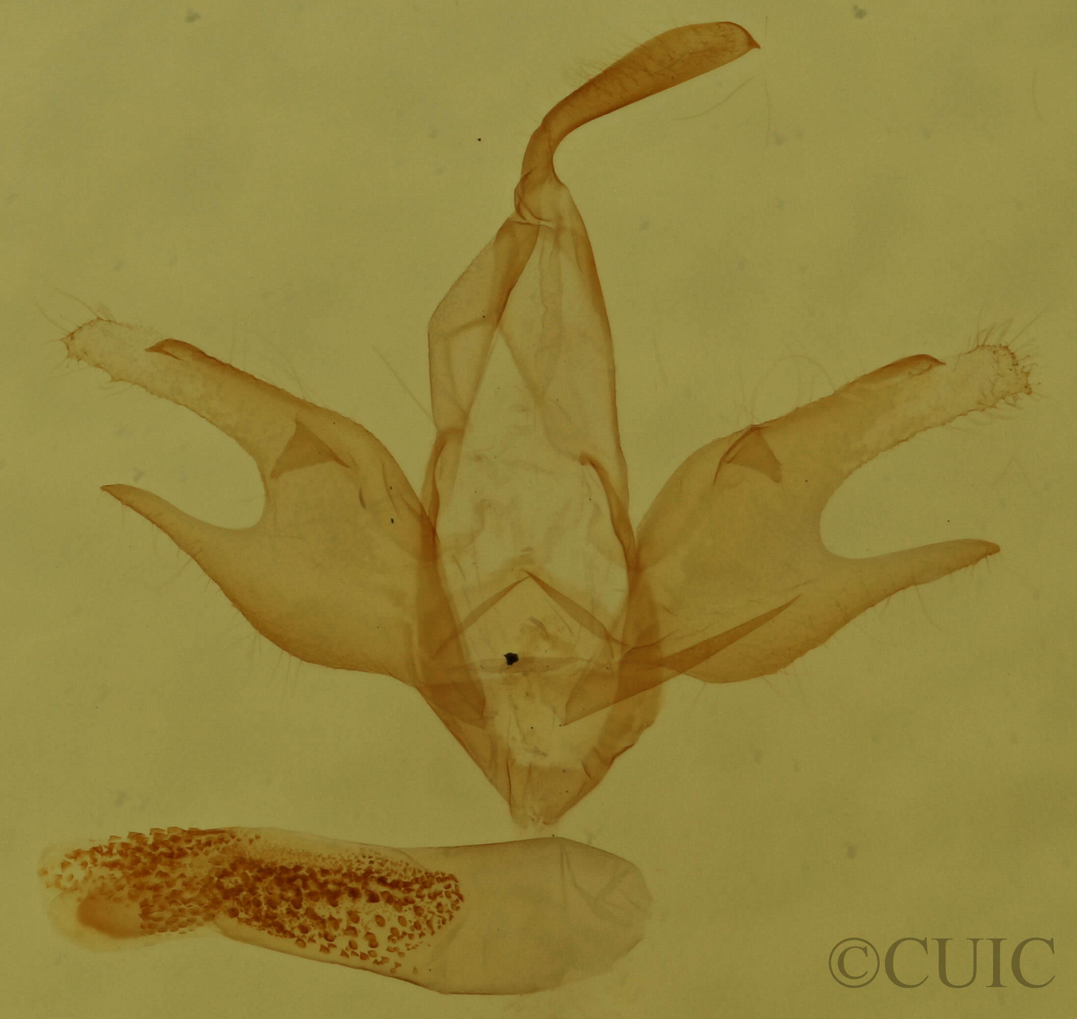genitalia view of adult Zanclognatha pedipilalis
