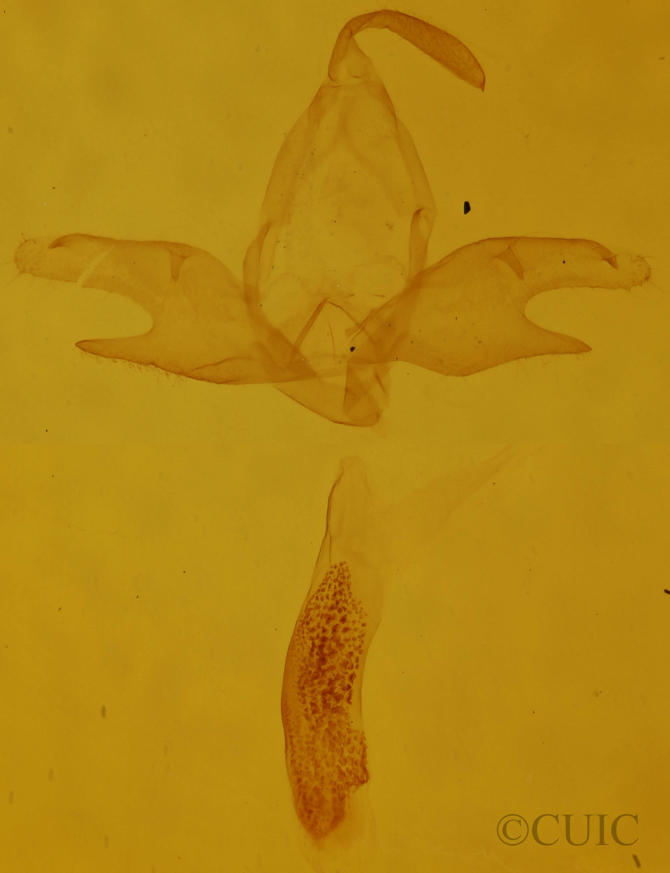 genitalia view of adult Zanclognatha pedipilalis