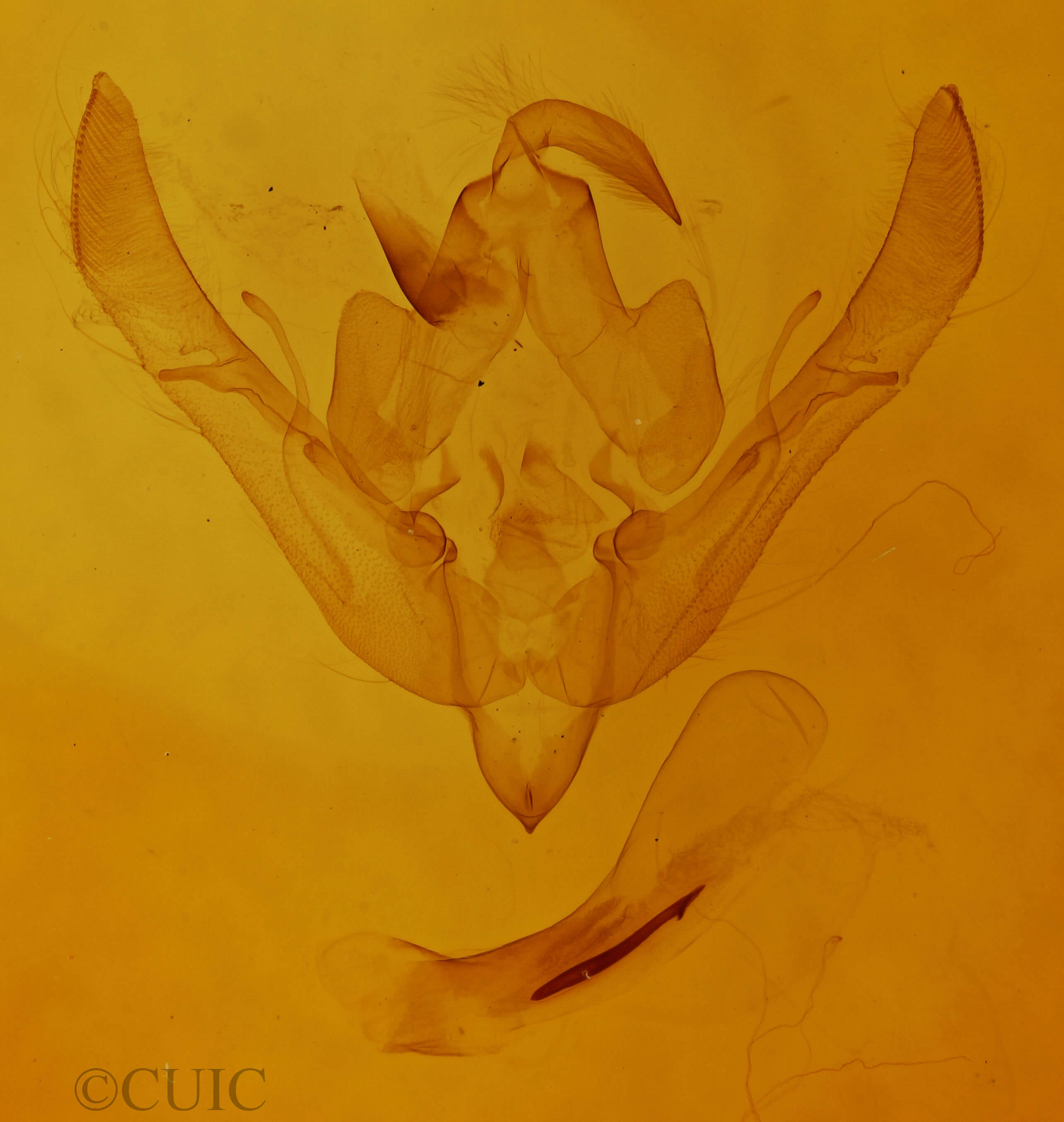 genitalia view of adult Agrochola helvola