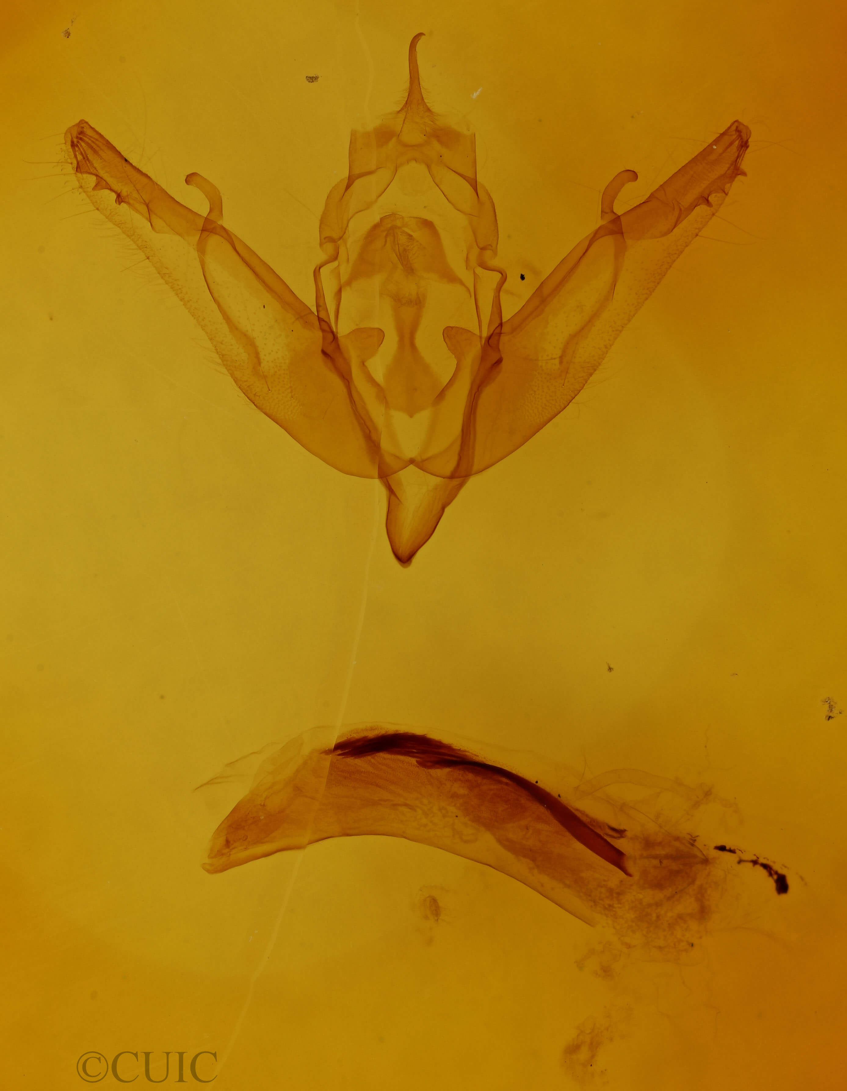 genitalia view of adult Agrochola litura