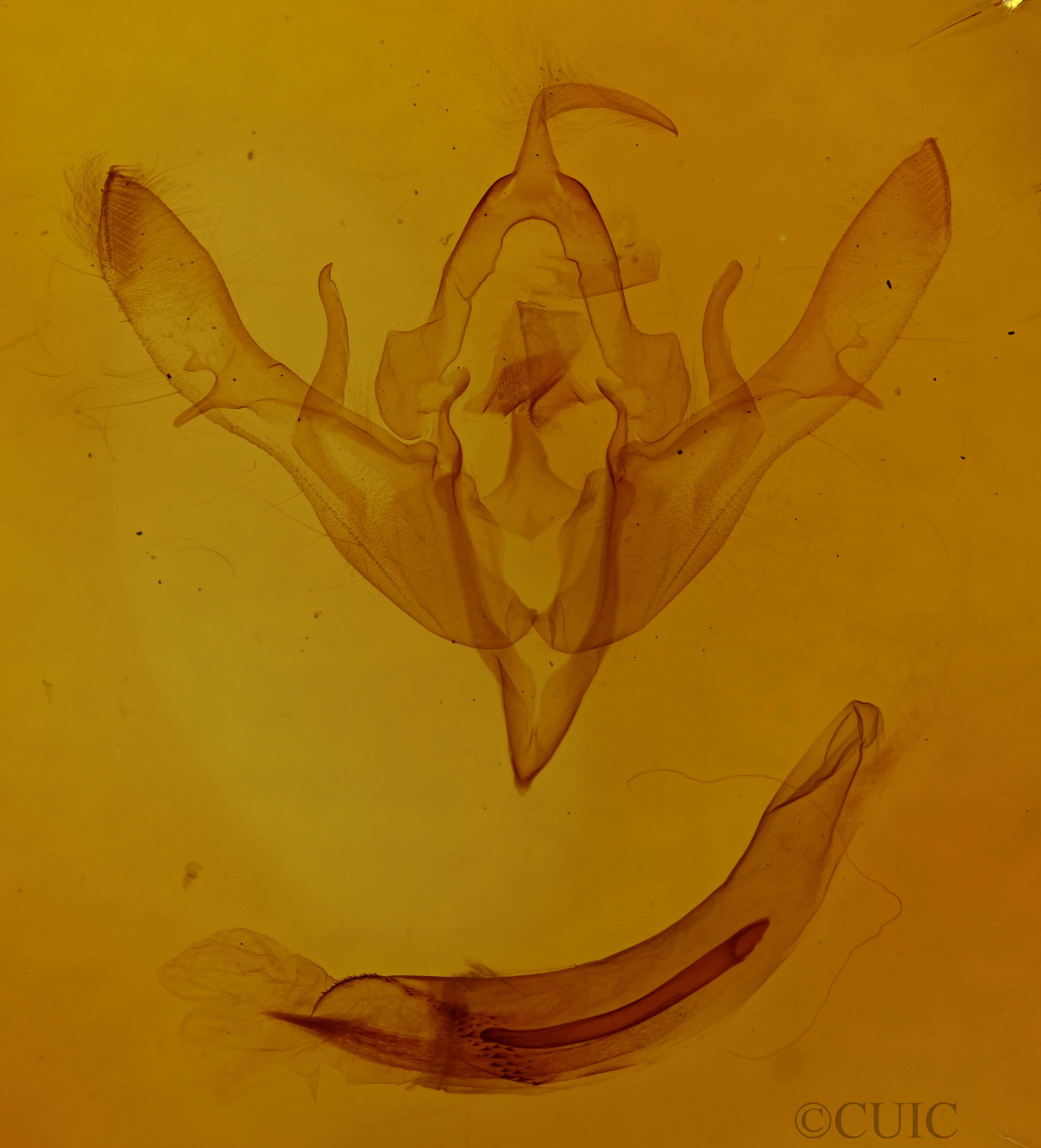 genitalia view of adult Agrochola lucida