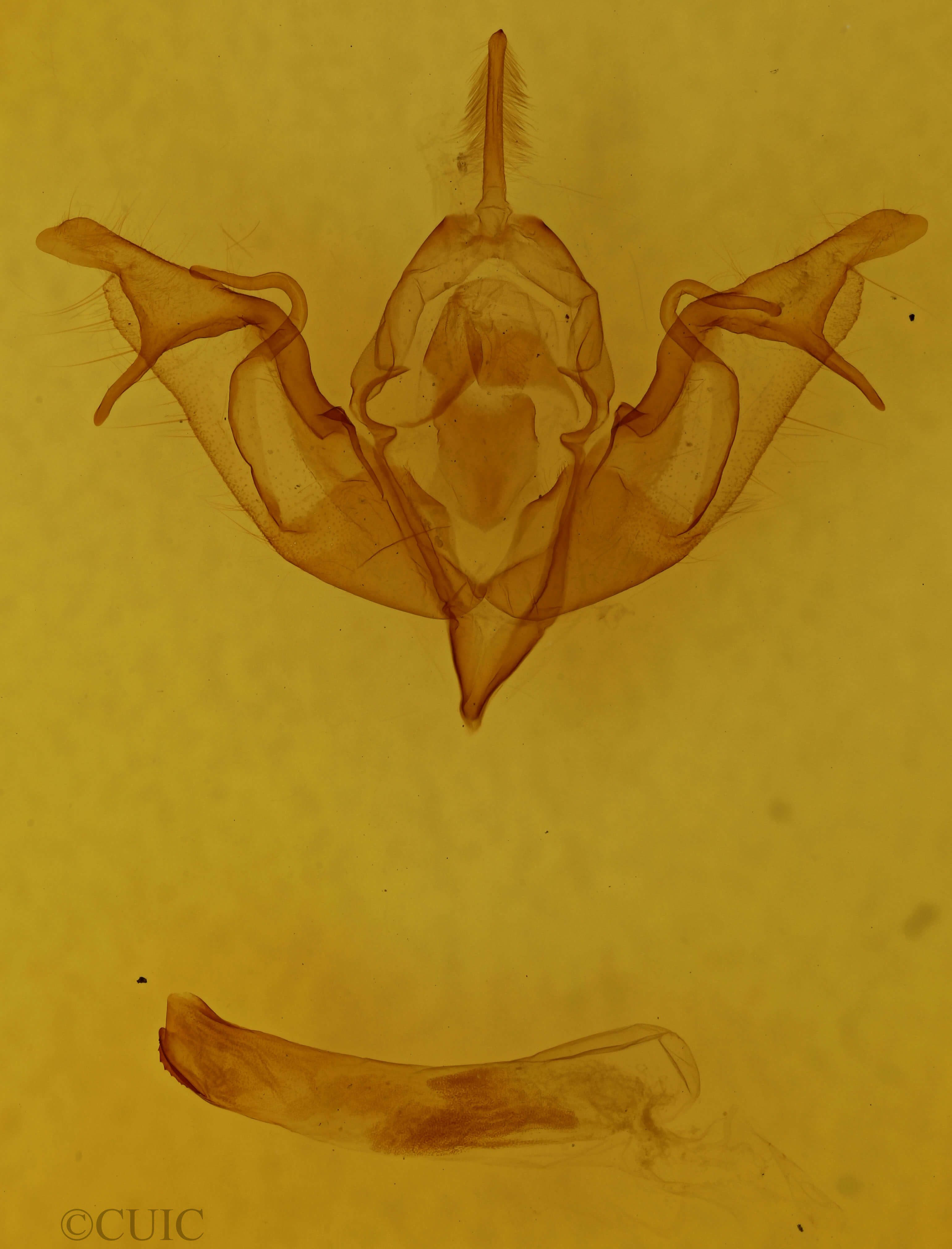 genitalia view of adult Agrochola lychnidis