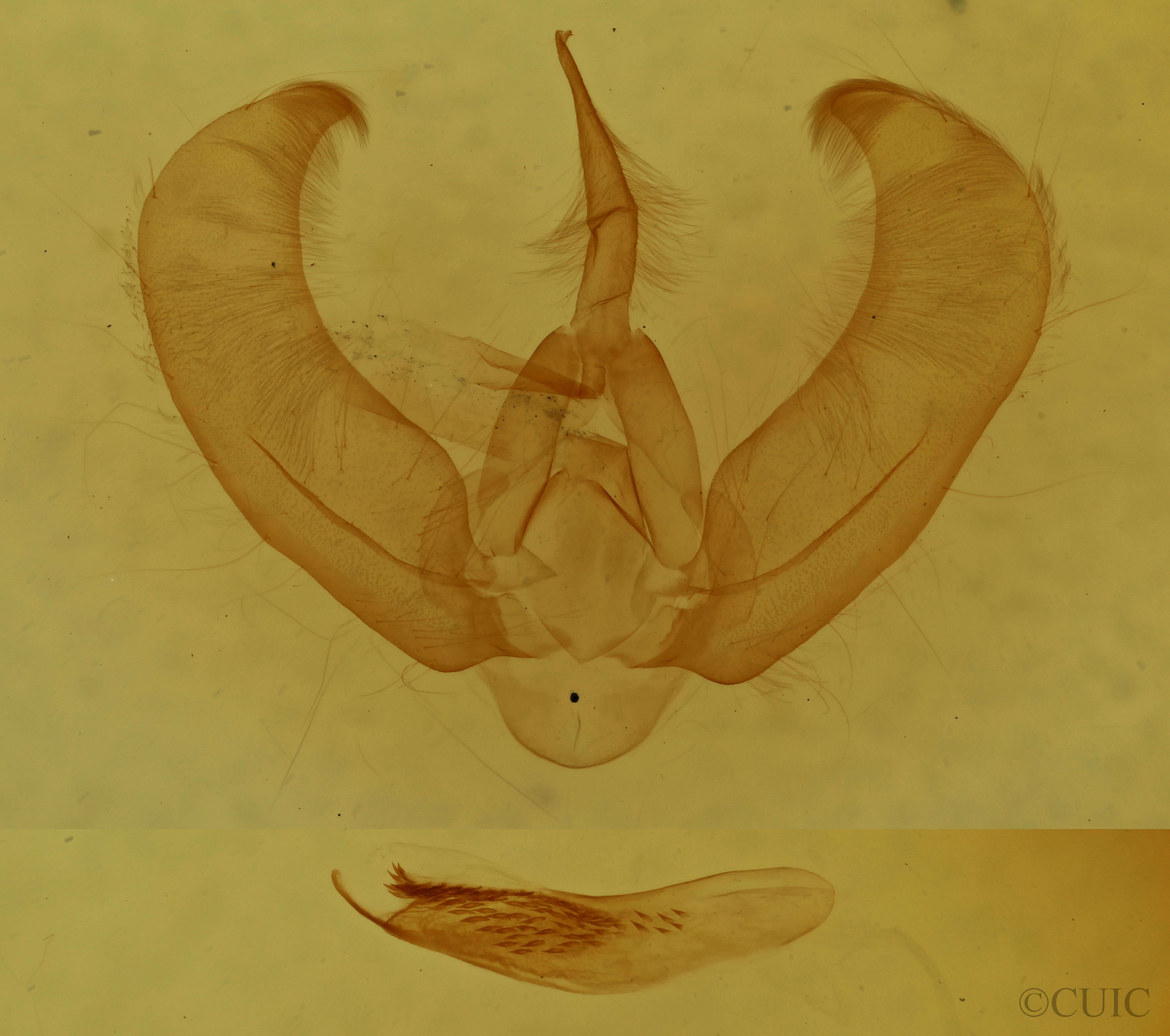 genitalia view of adult Amphipyra glabella