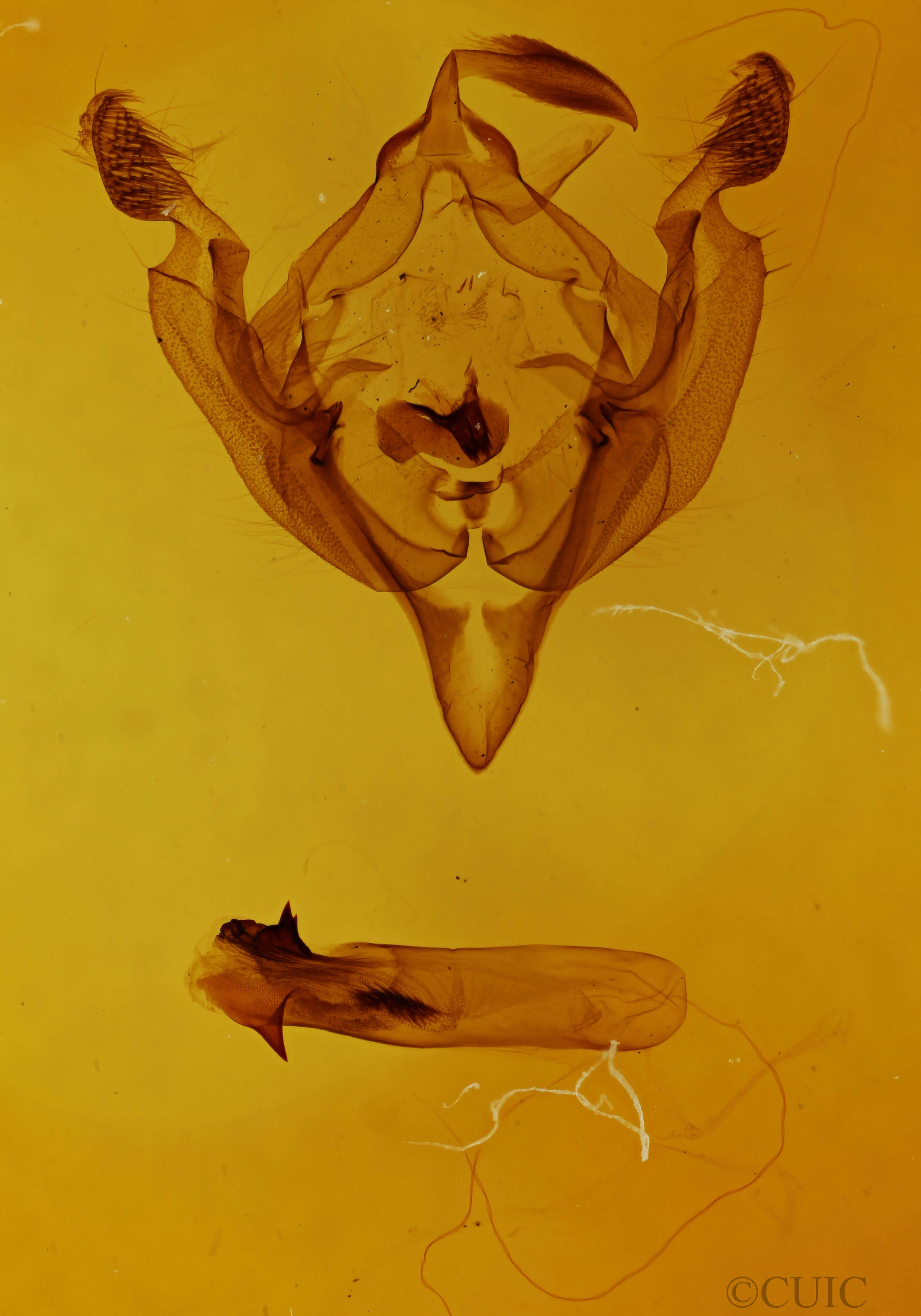 genitalia view of adult Hadena capsularis