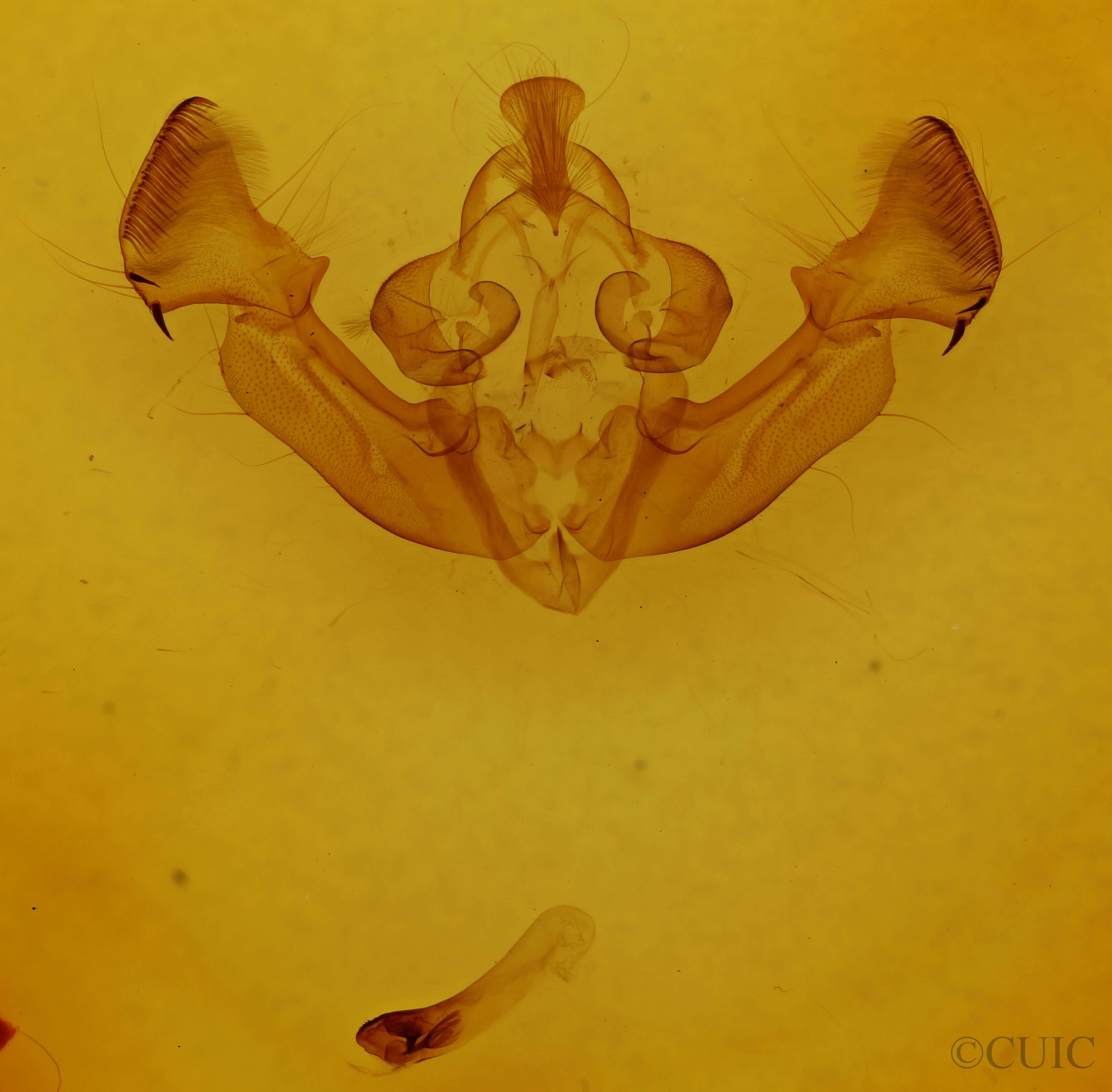 genitalia view of adult Apamea cariosa