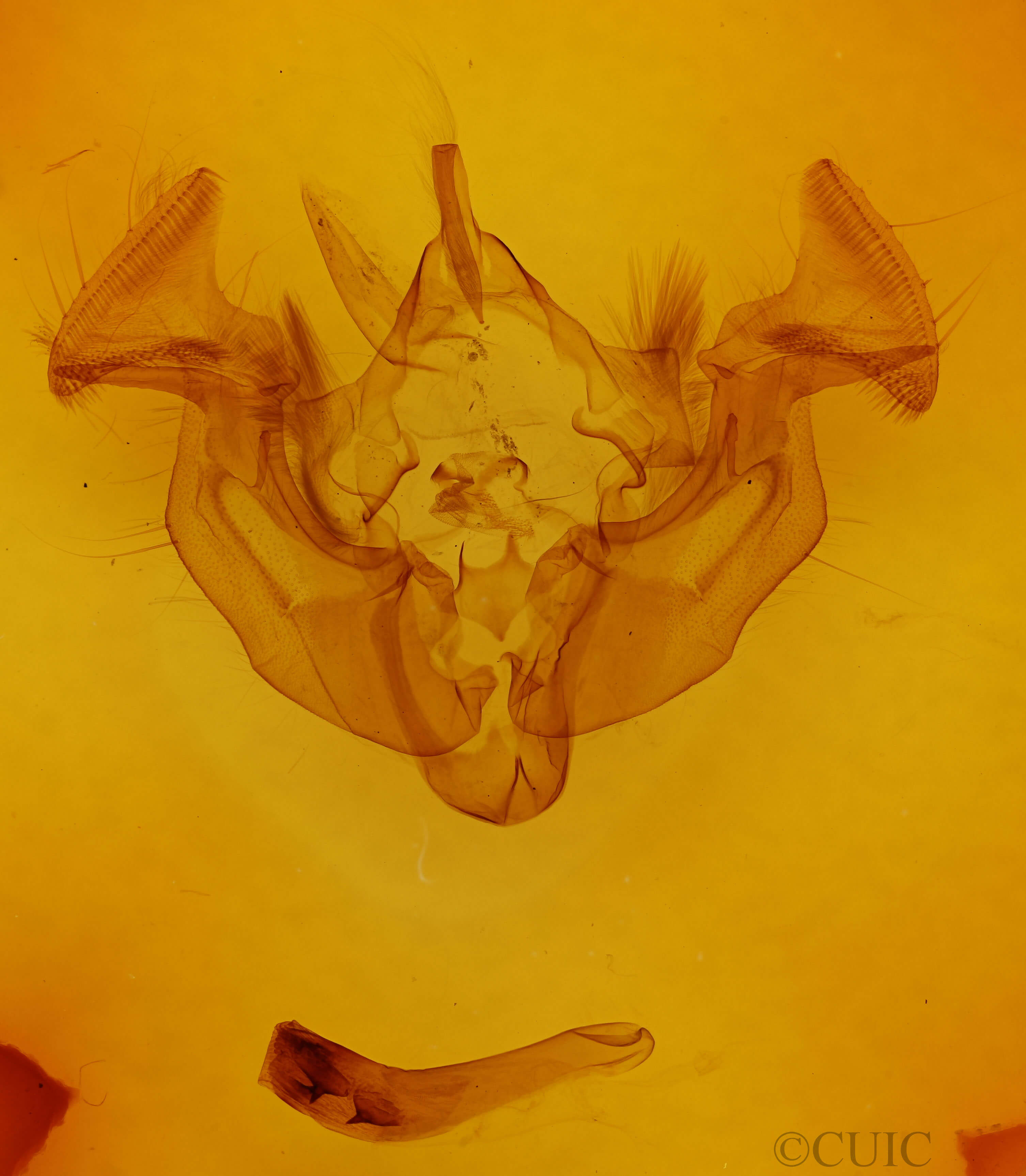 genitalia view of adult Apamea cogitata