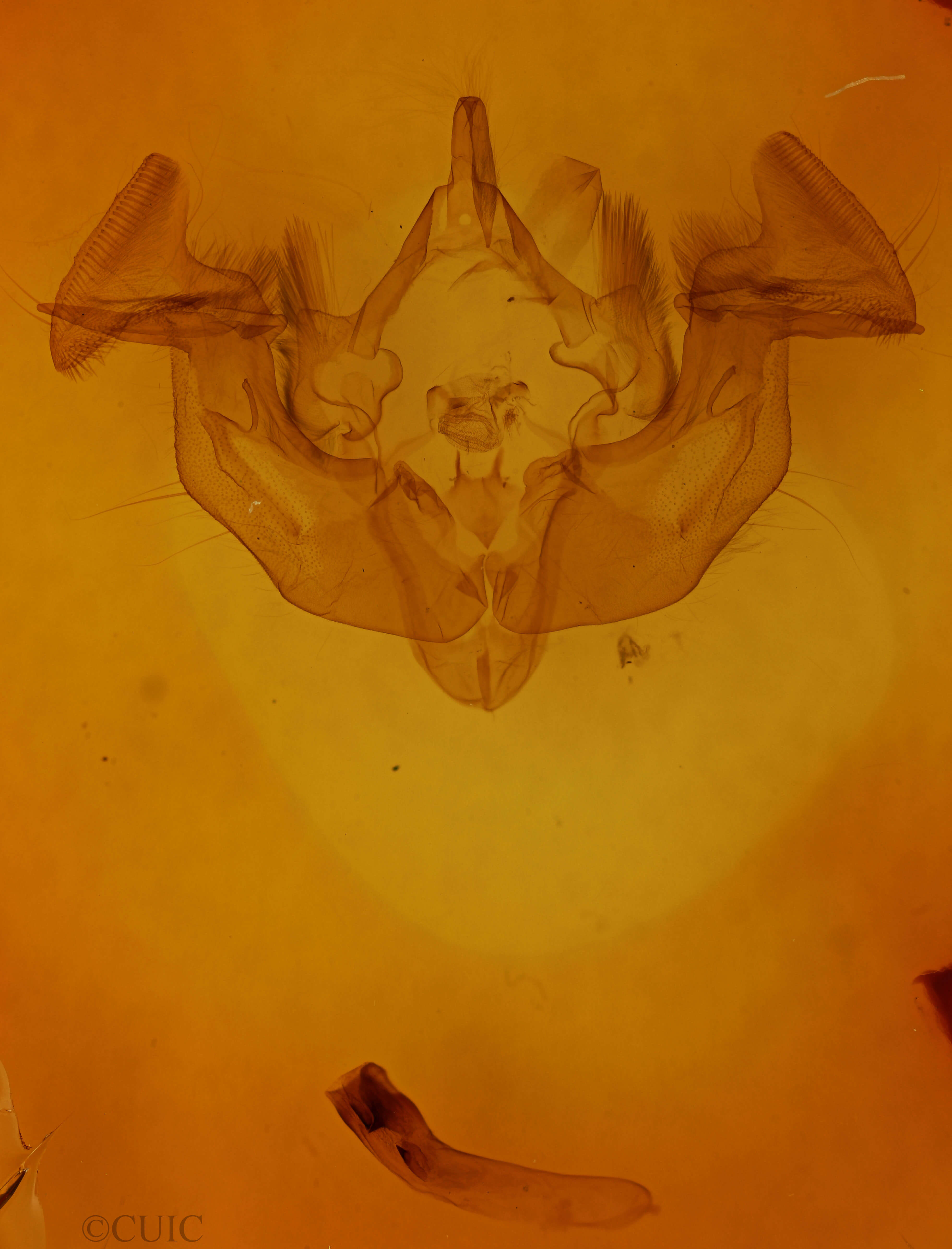 genitalia view of adult Apamea cogitata