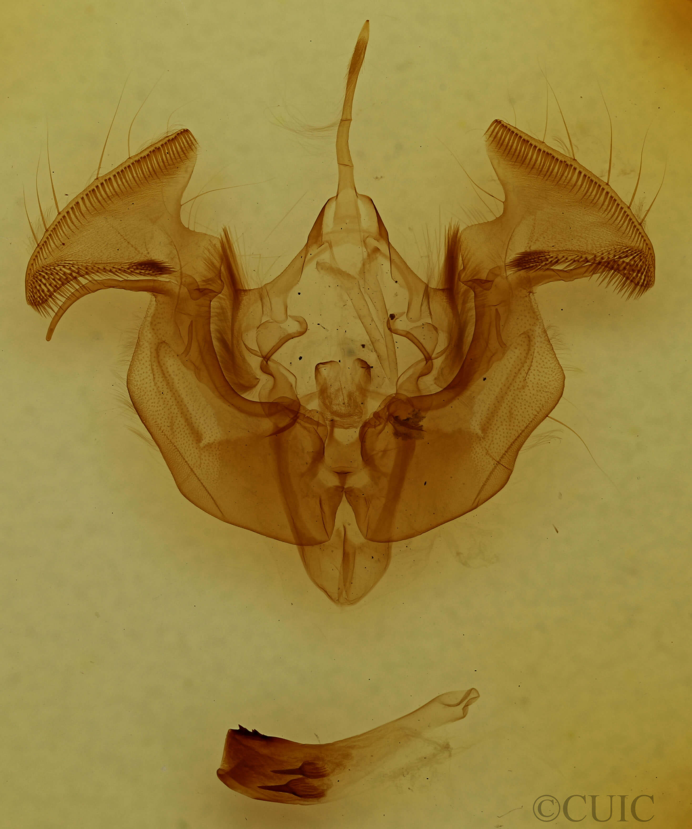 genitalia view of adult Apamea dubitans