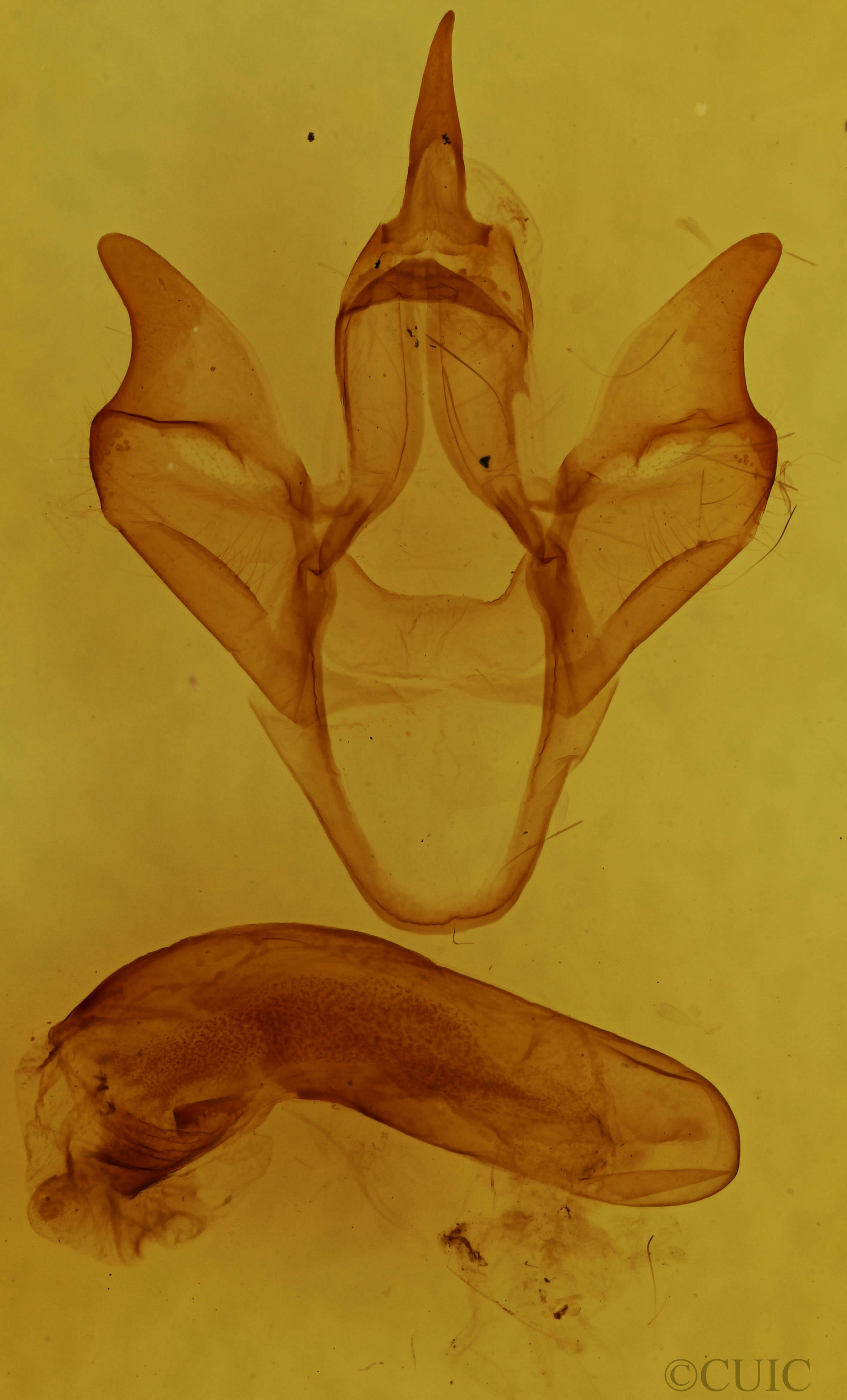 genitalia view of adult Apantesis anna