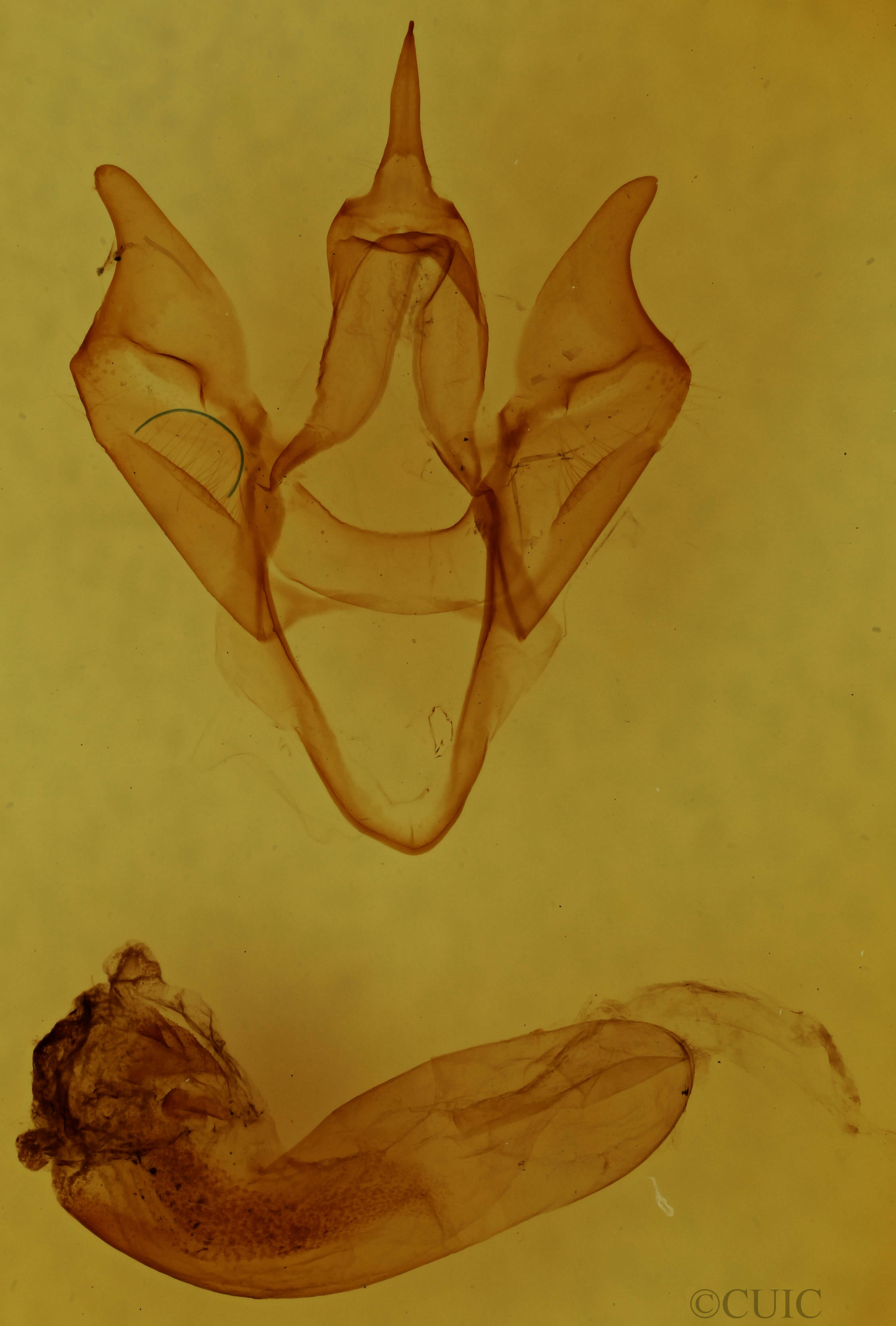 genitalia view of adult Apantesis anna