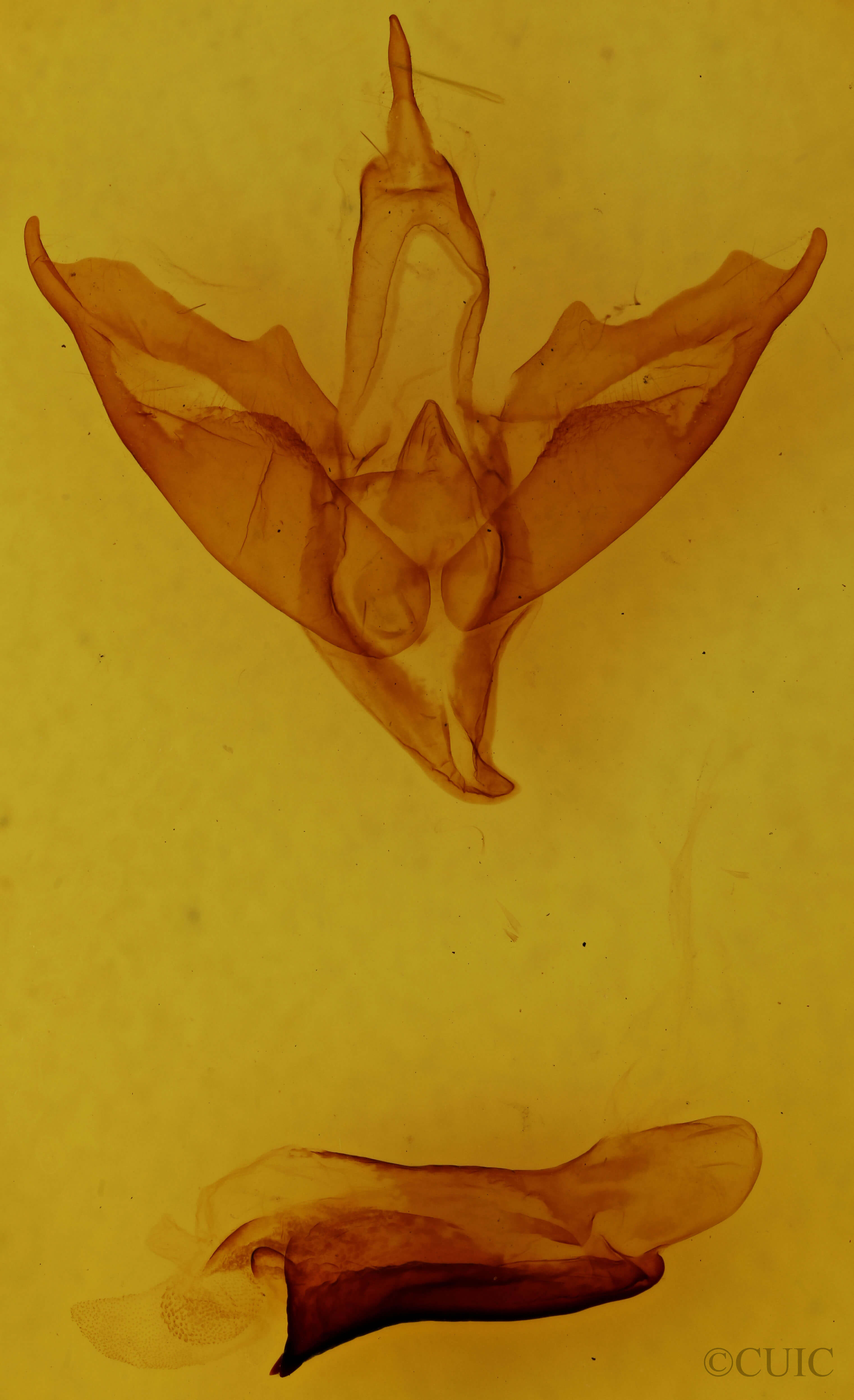 genitalia view of adult Apantesis phalerata