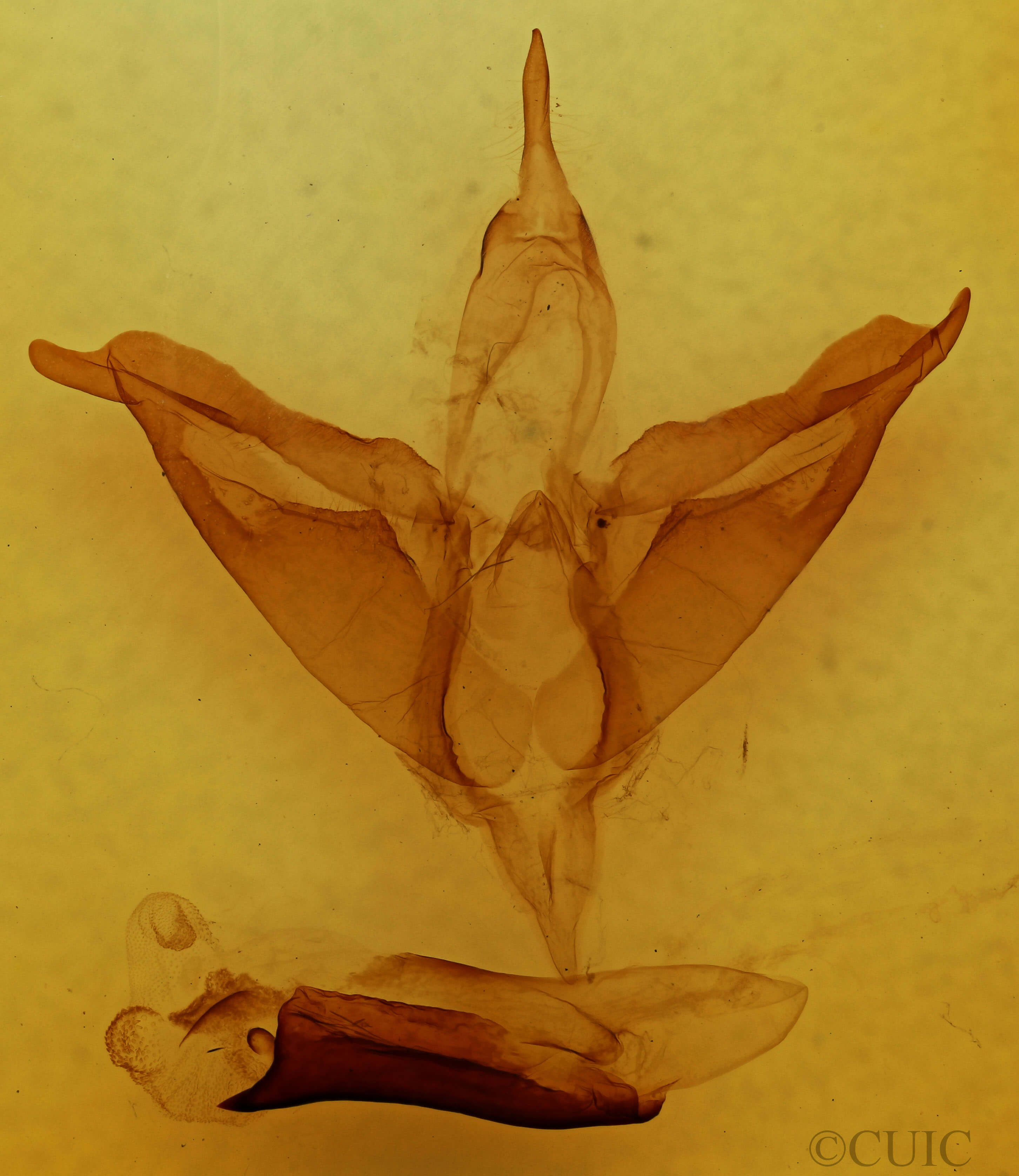 genitalia view of adult Apantesis phalerata