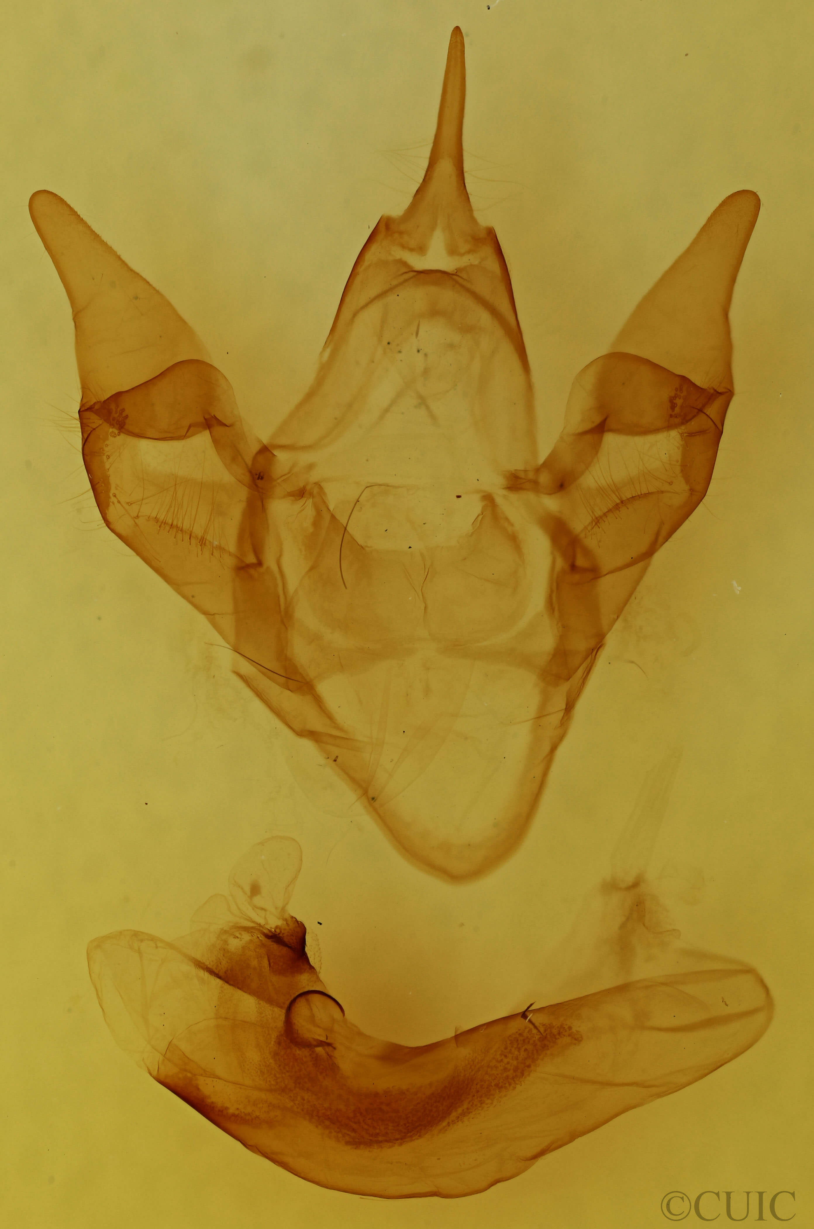 genitalia view of adult Apantesis virgo