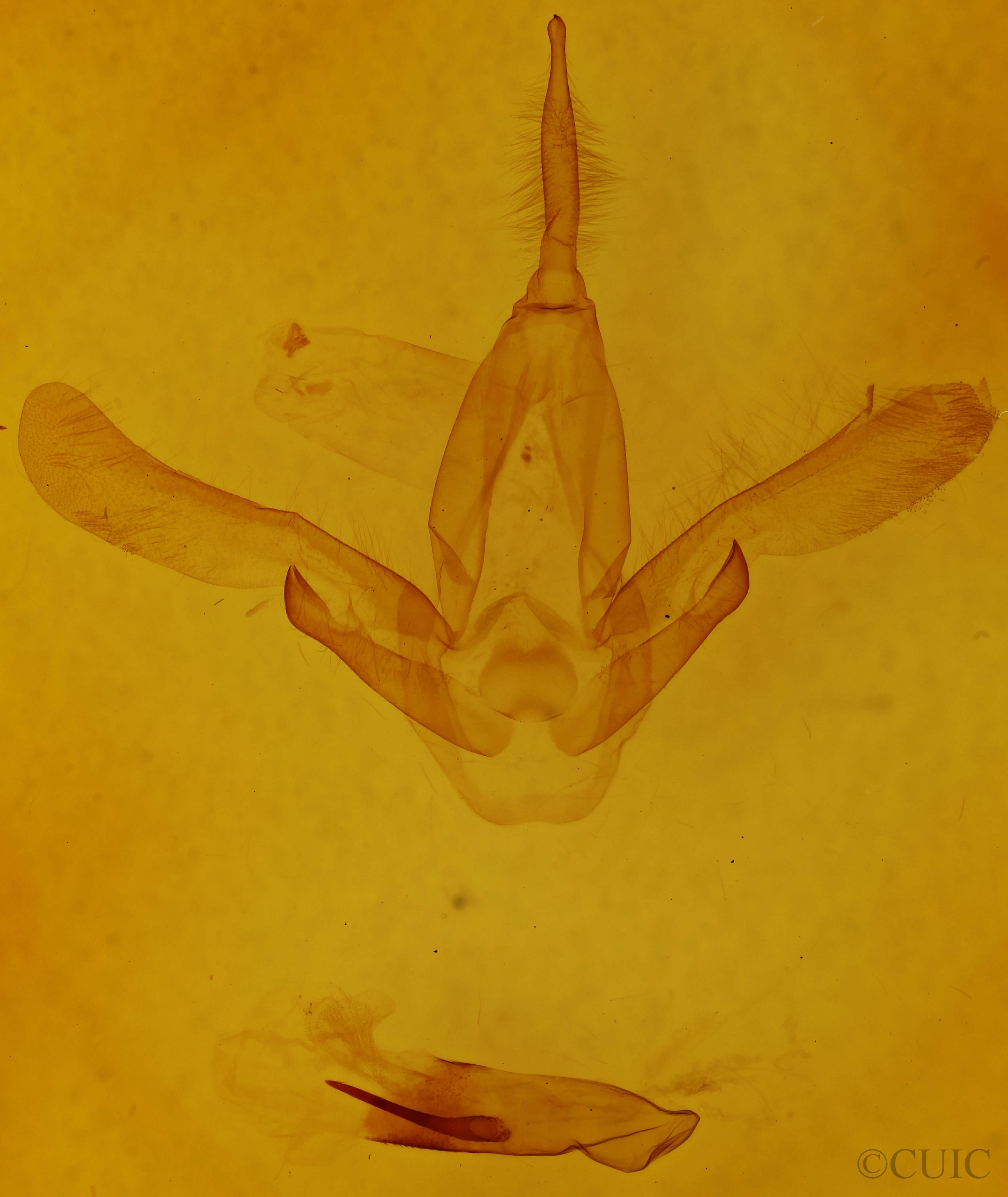 genitalia view of adult Asota caricae