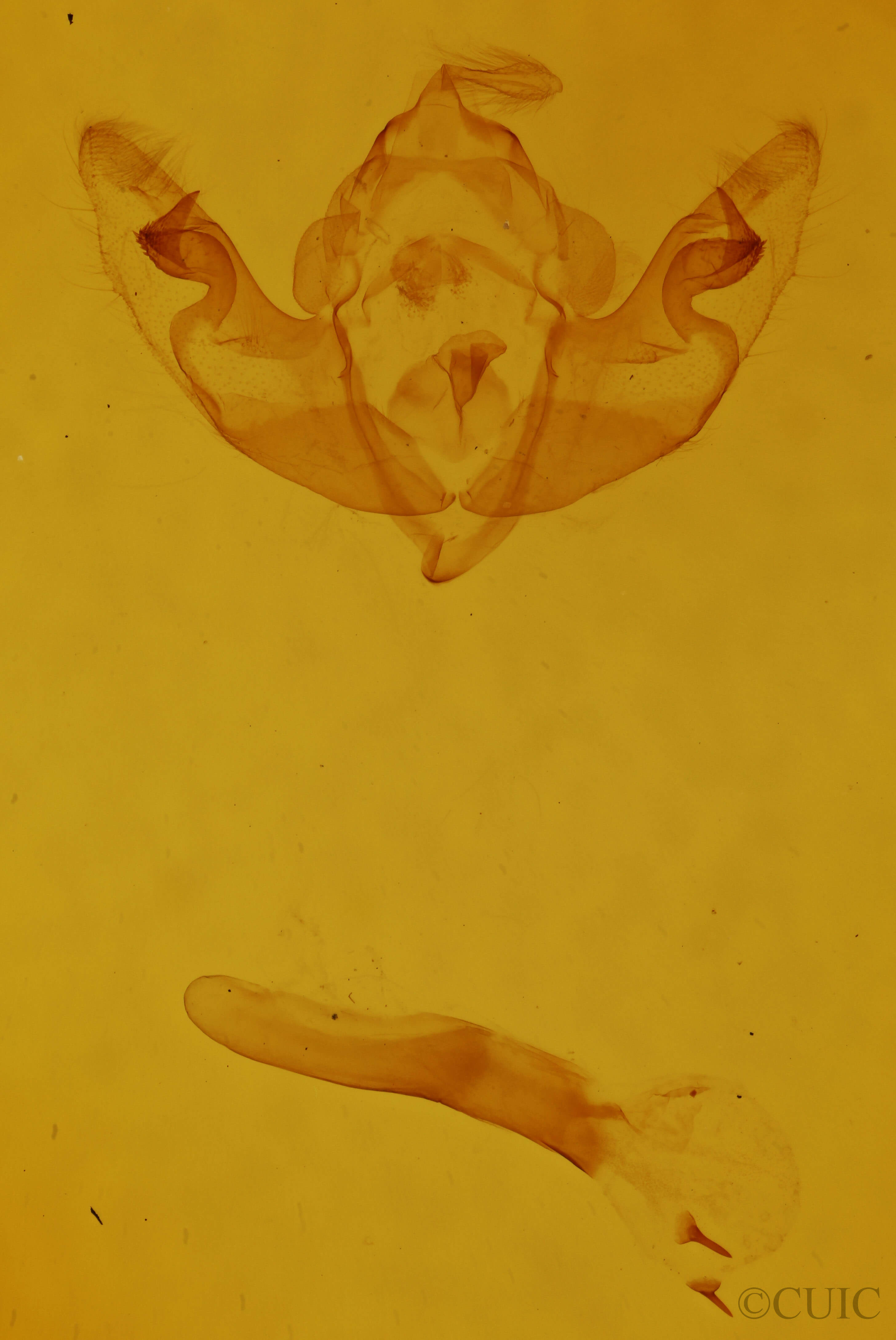 genitalia view of adult Atethmia ambusta