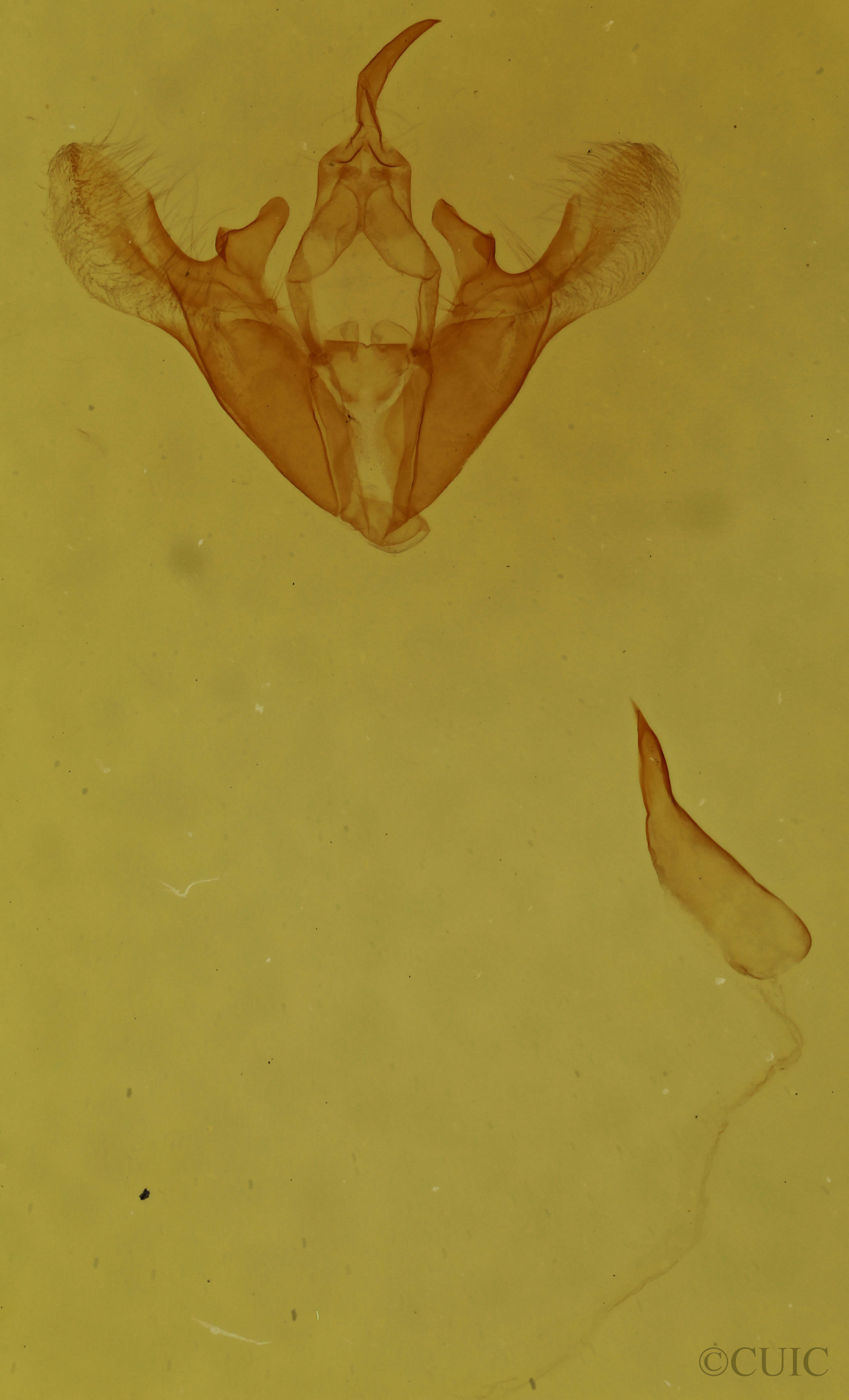 genitalia view of adult Erastria coloraria