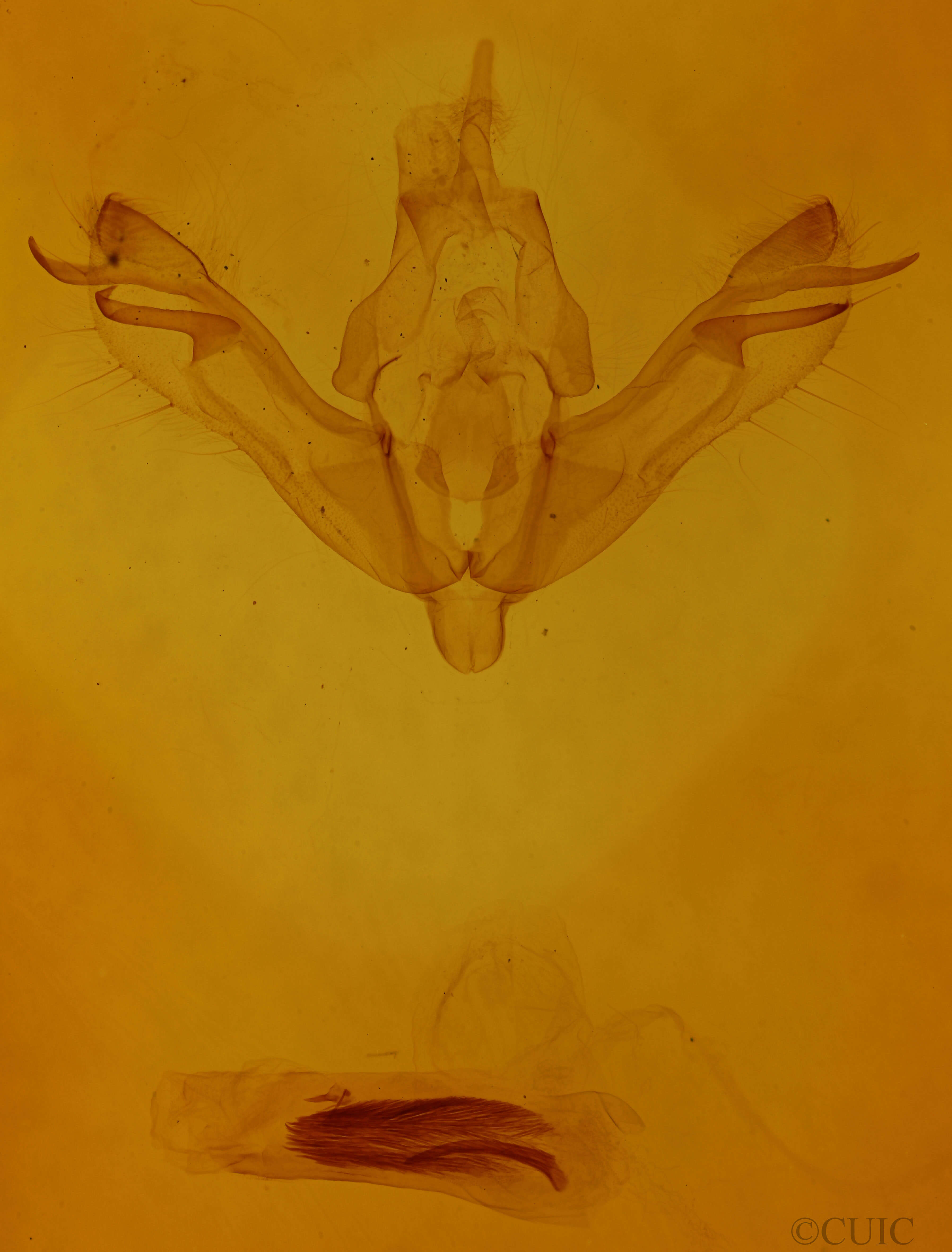 genitalia view of adult Xanthia gilvago