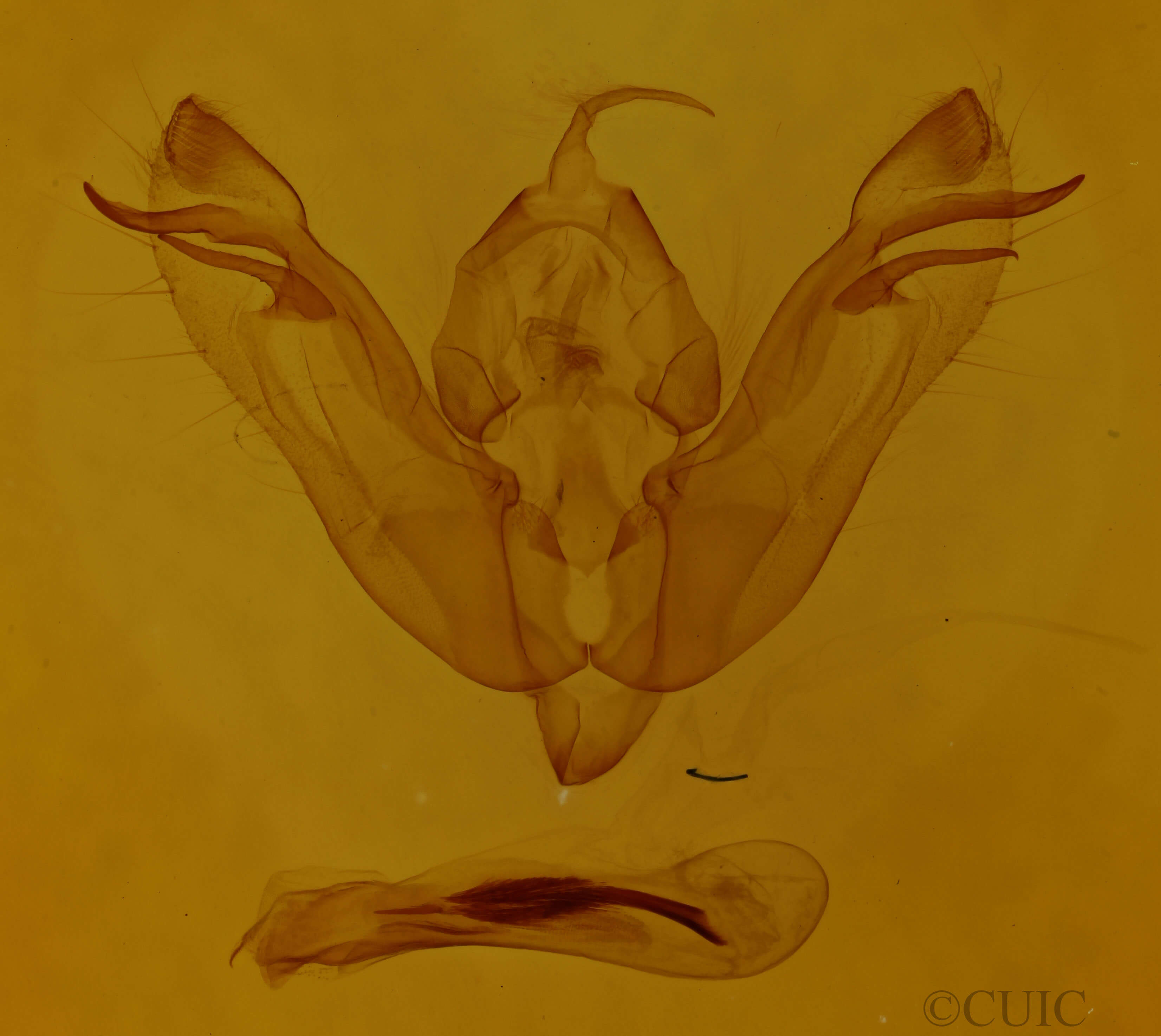 genitalia view of adult Xanthia tunicata