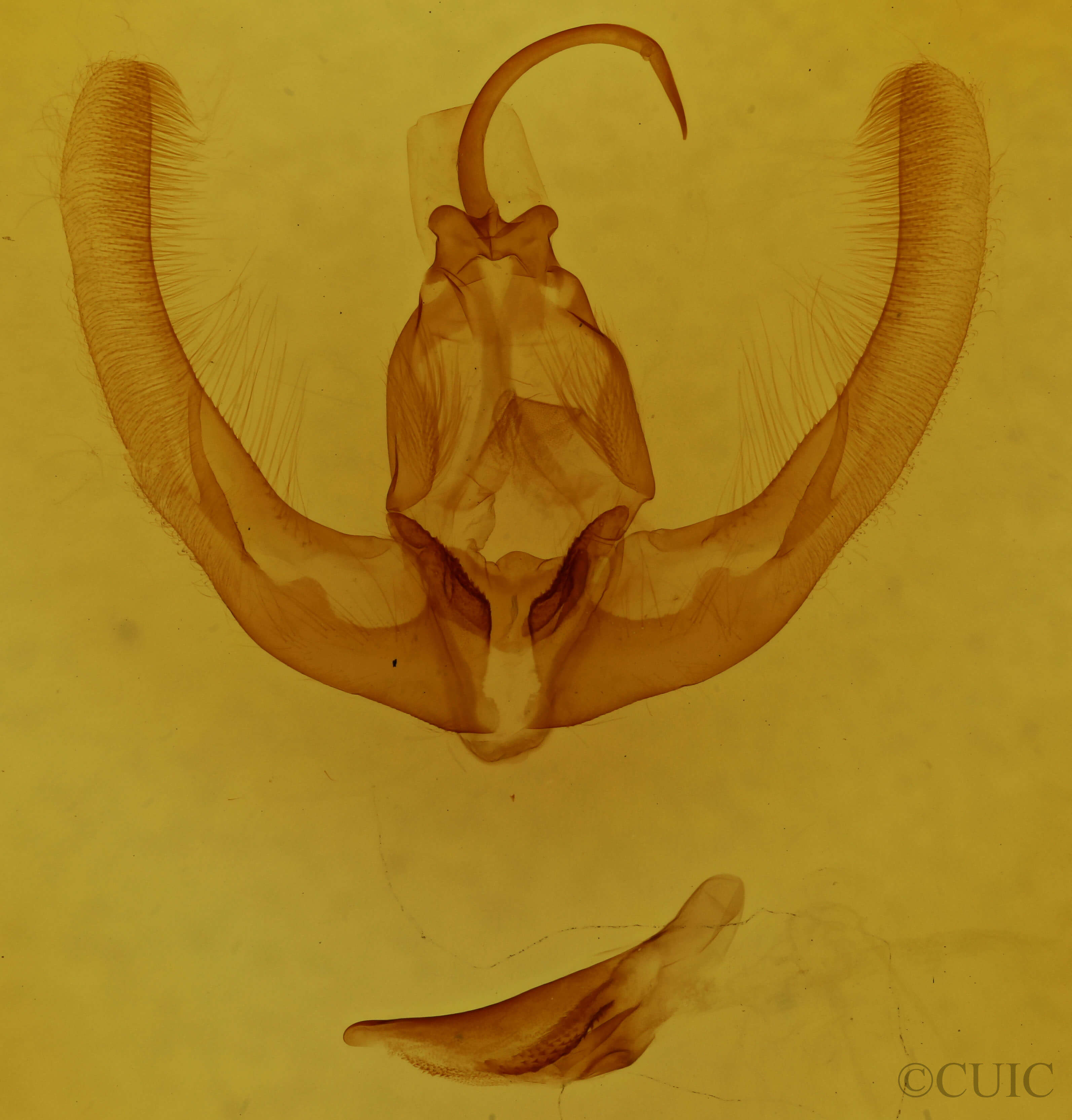genitalia view of adult Condica