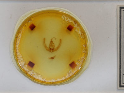 slide view of adult Condica