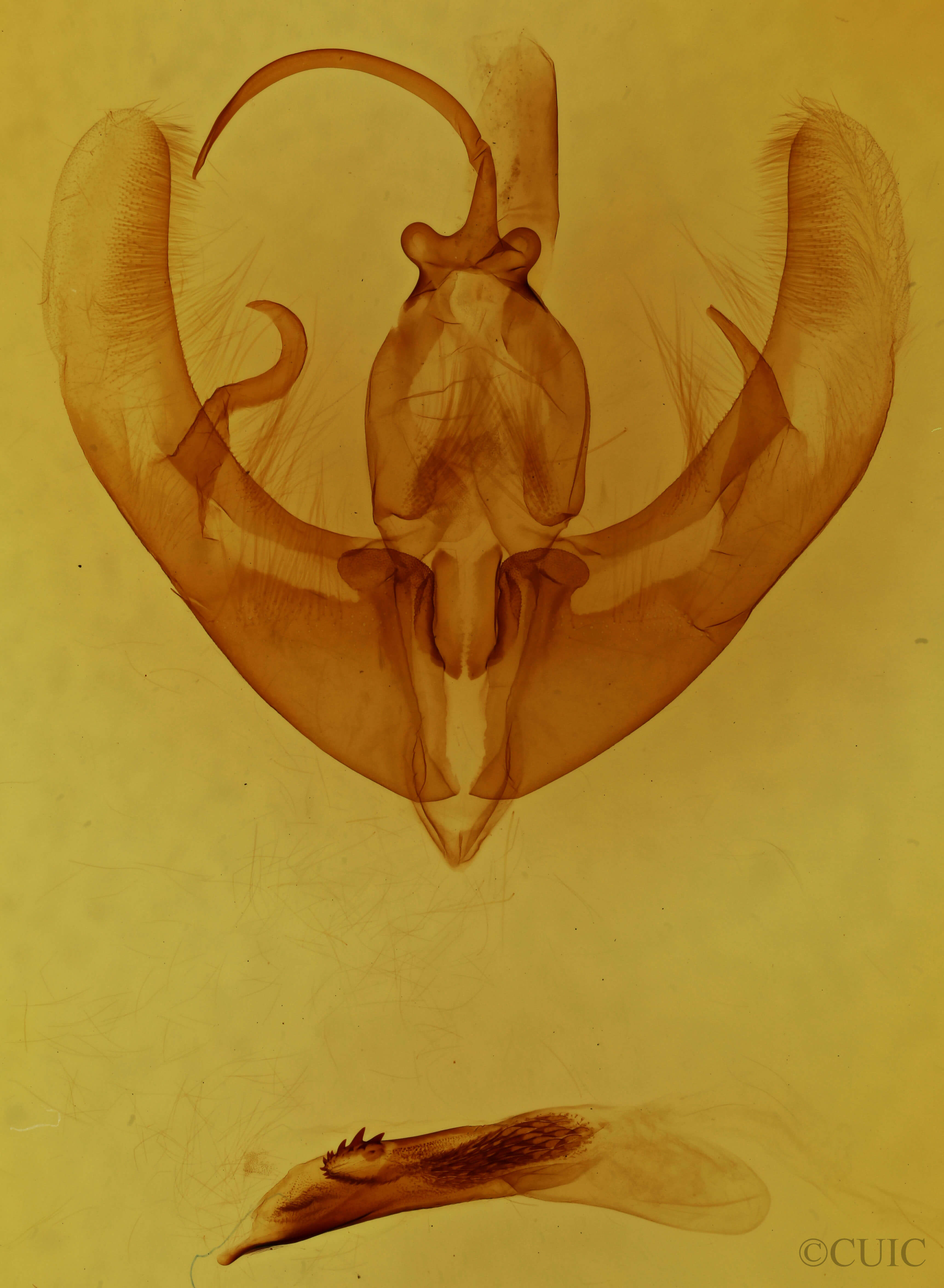 genitalia view of adult Condica confederata