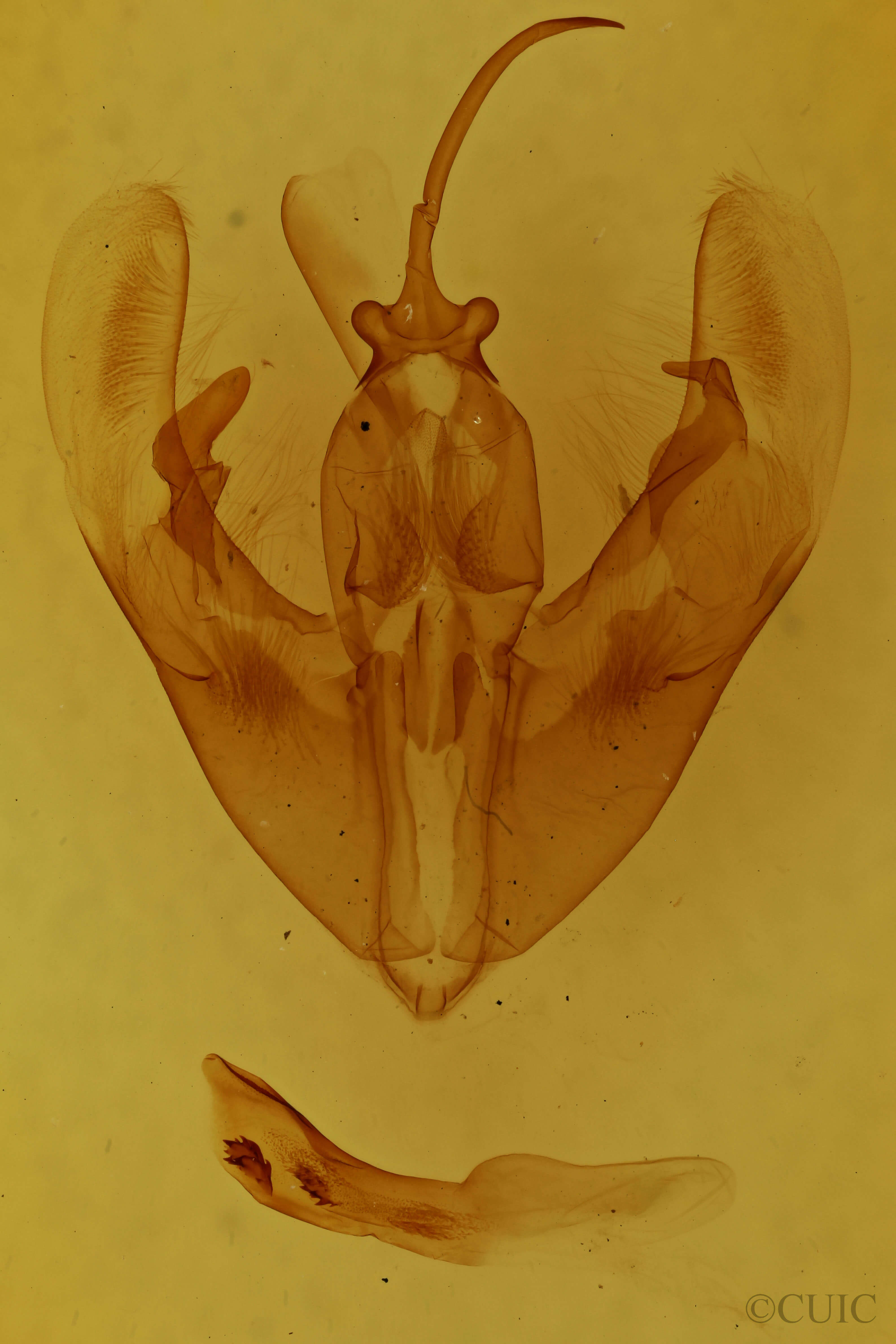 genitalia view of adult Condica