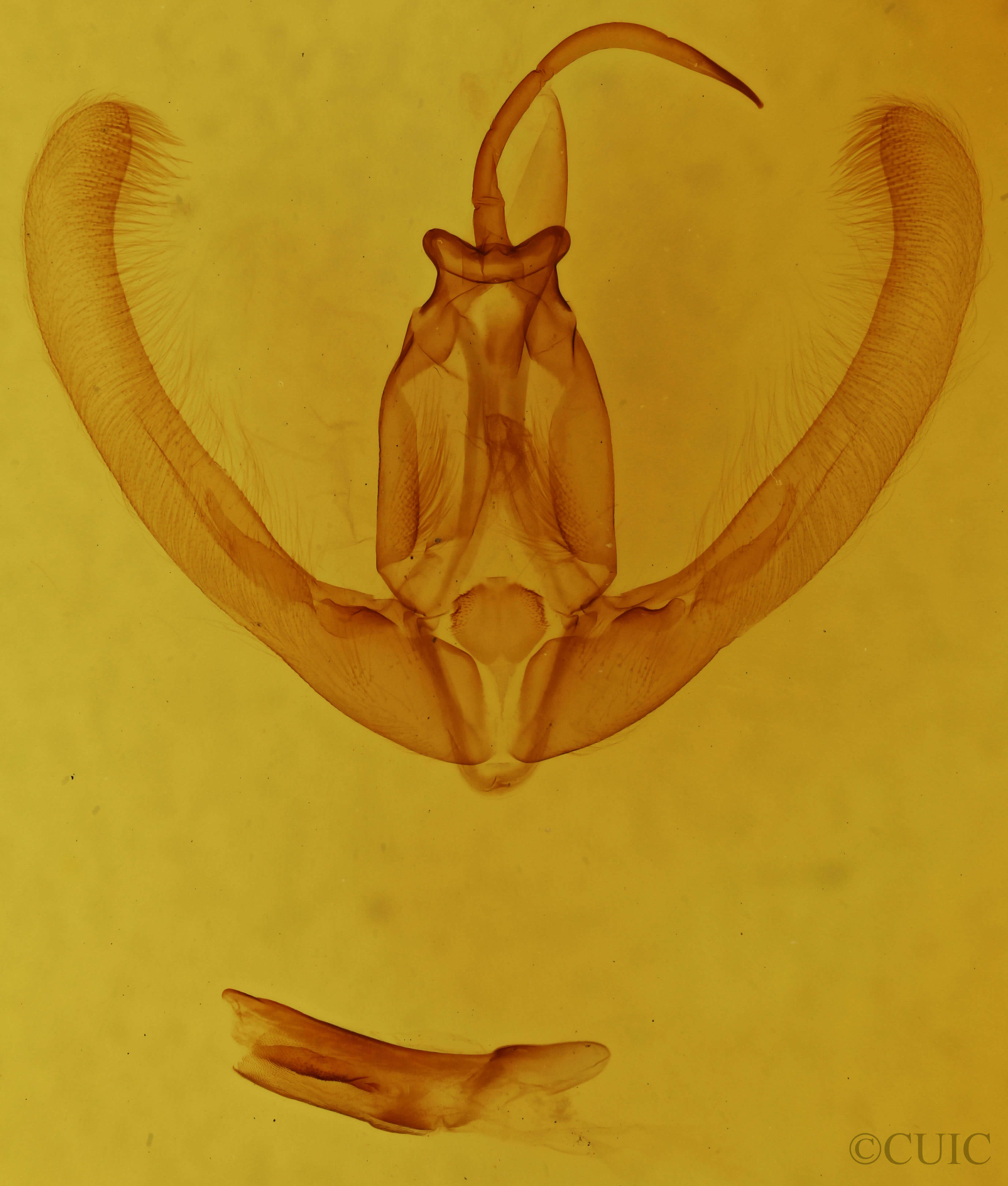 genitalia view of adult Condica