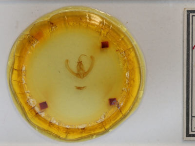 slide view of adult Condica