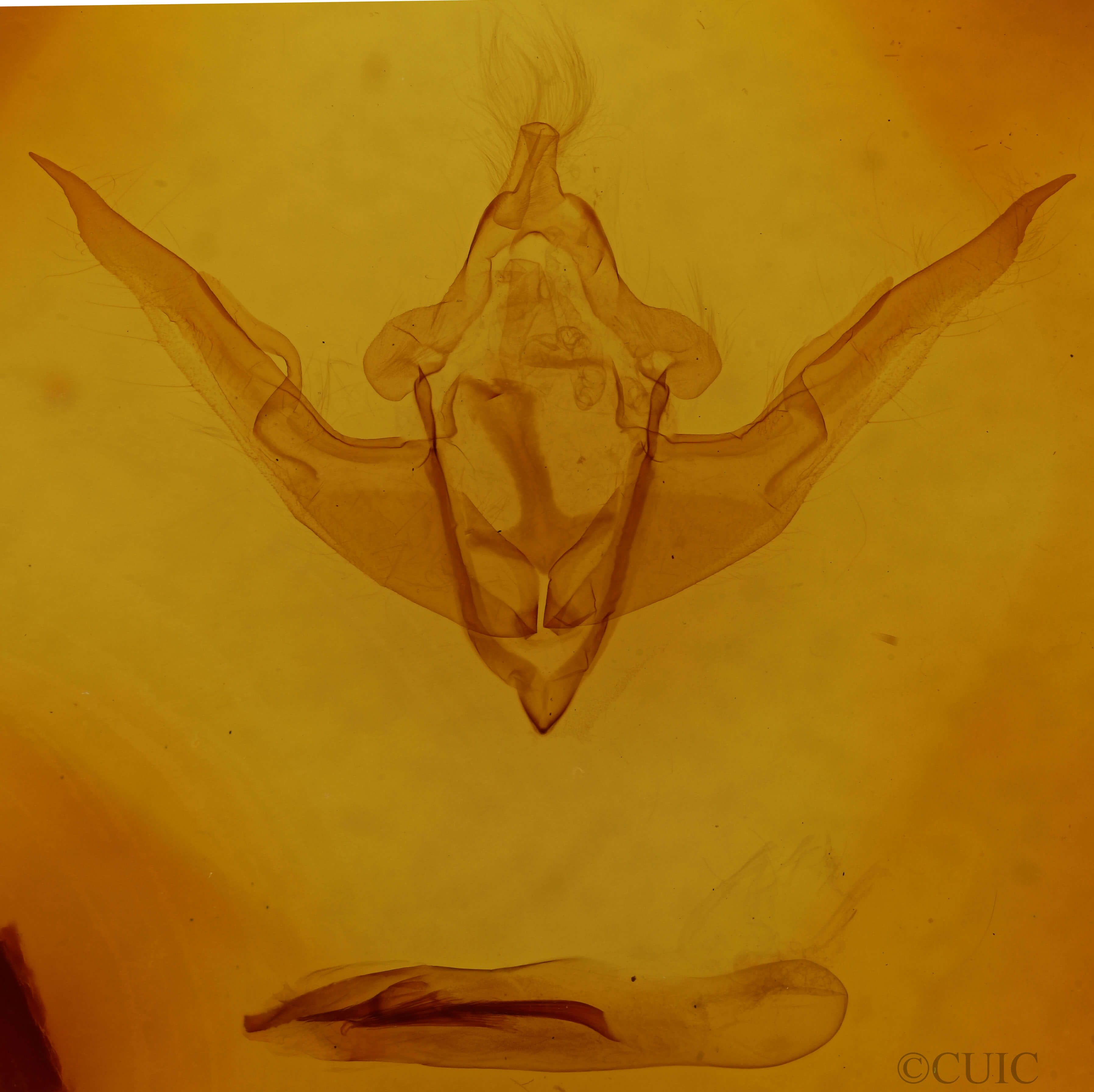 genitalia view of adult Conistra veronicae
