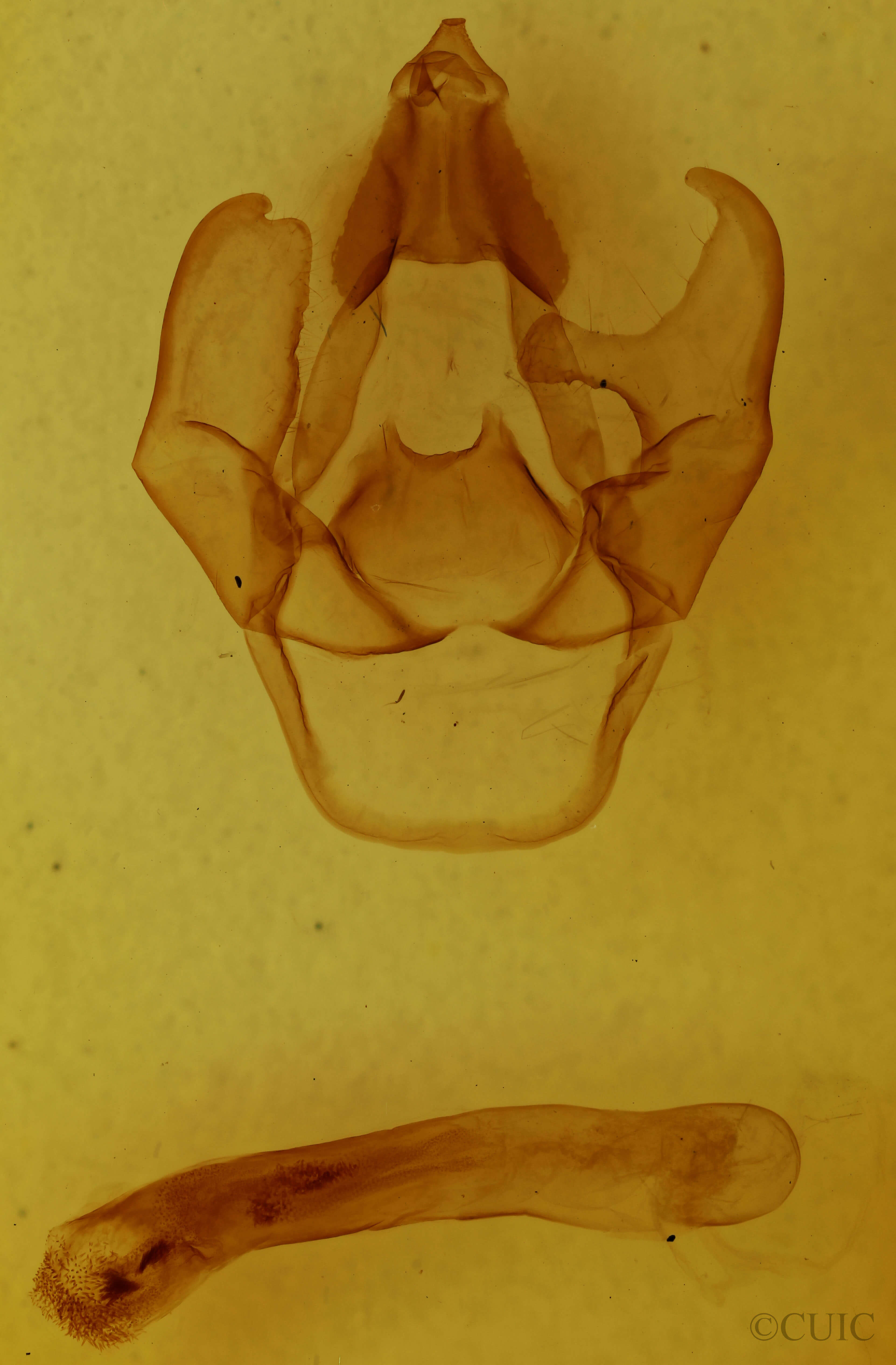 genitalia view of adult Estigmene acrea