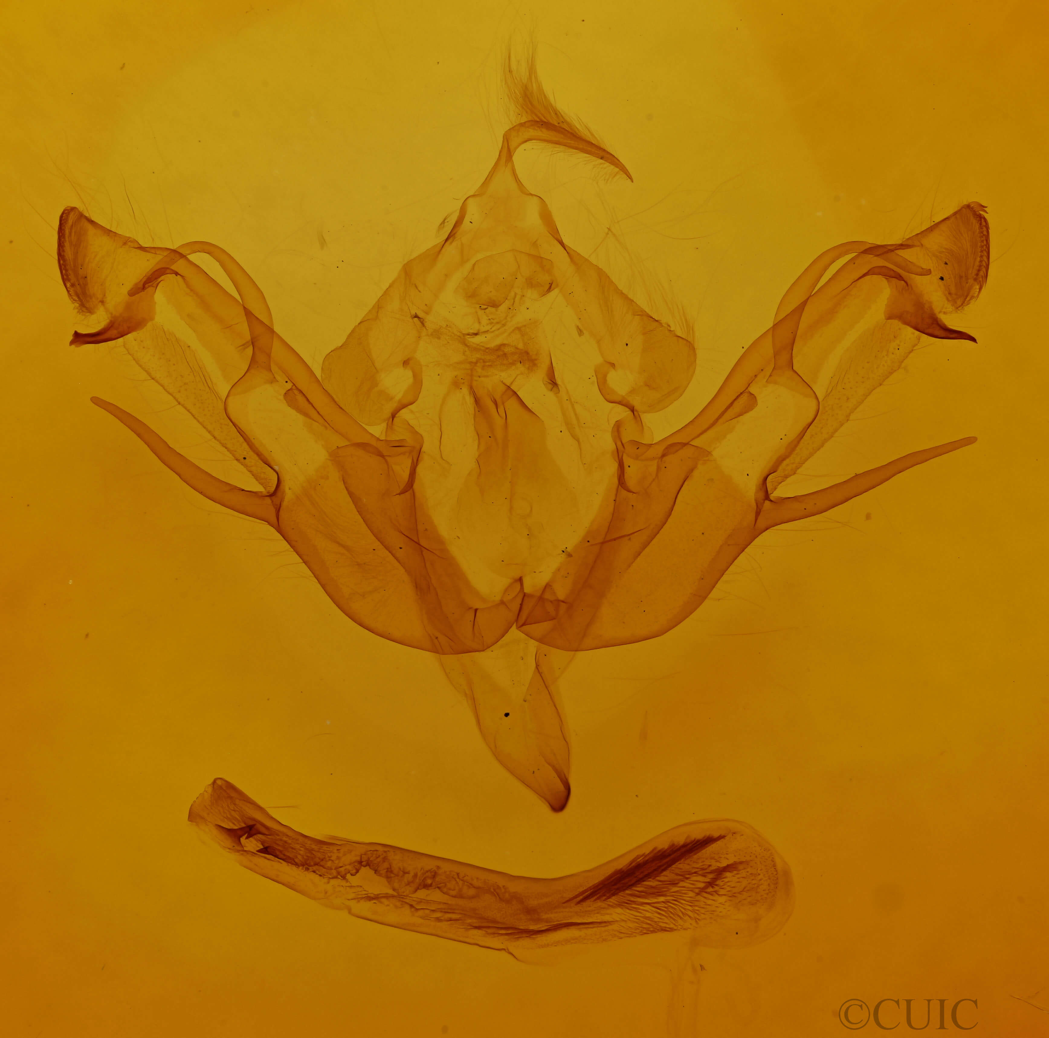 genitalia view of adult Eupsilia transversa