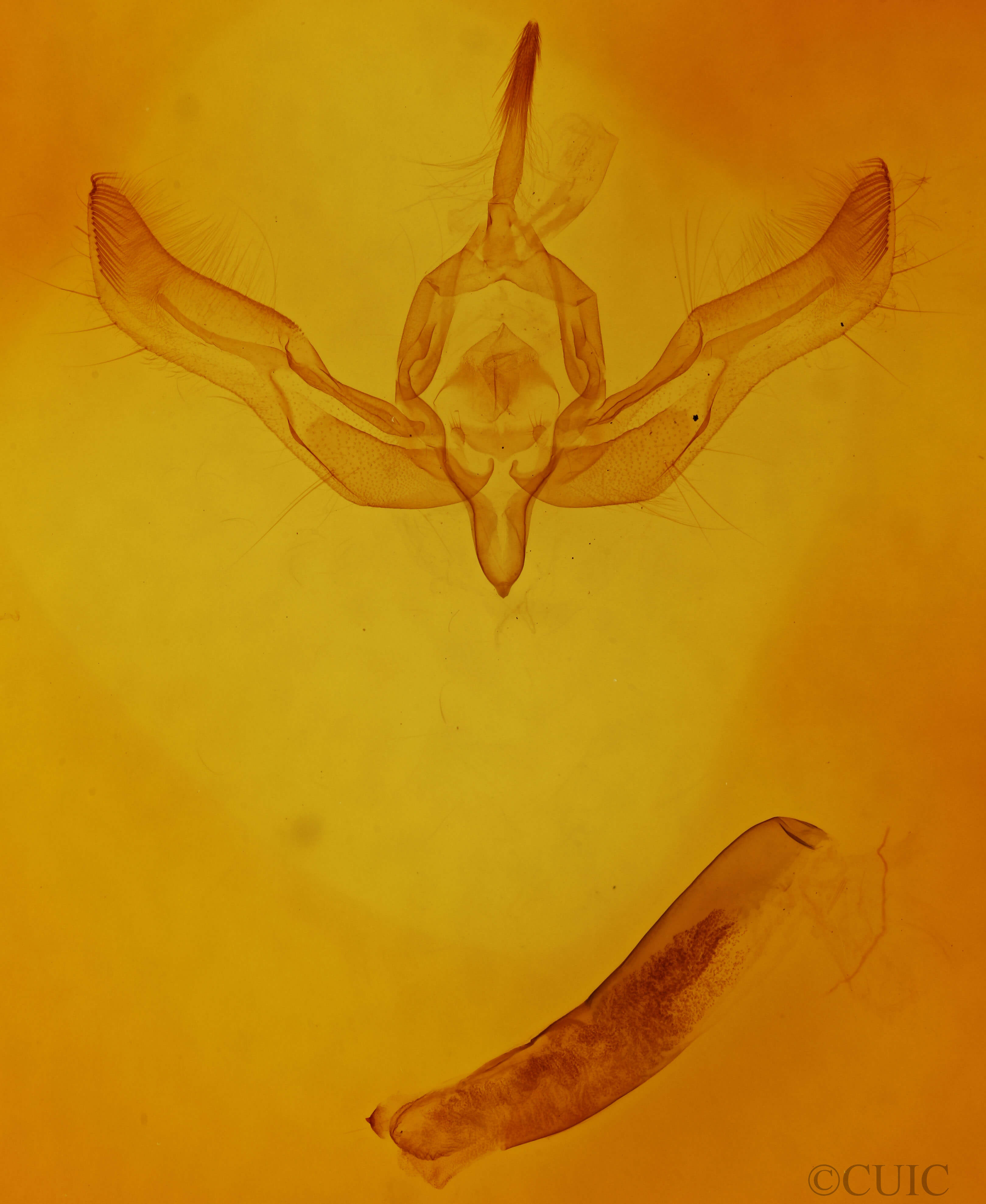 genitalia view of adult Feltia