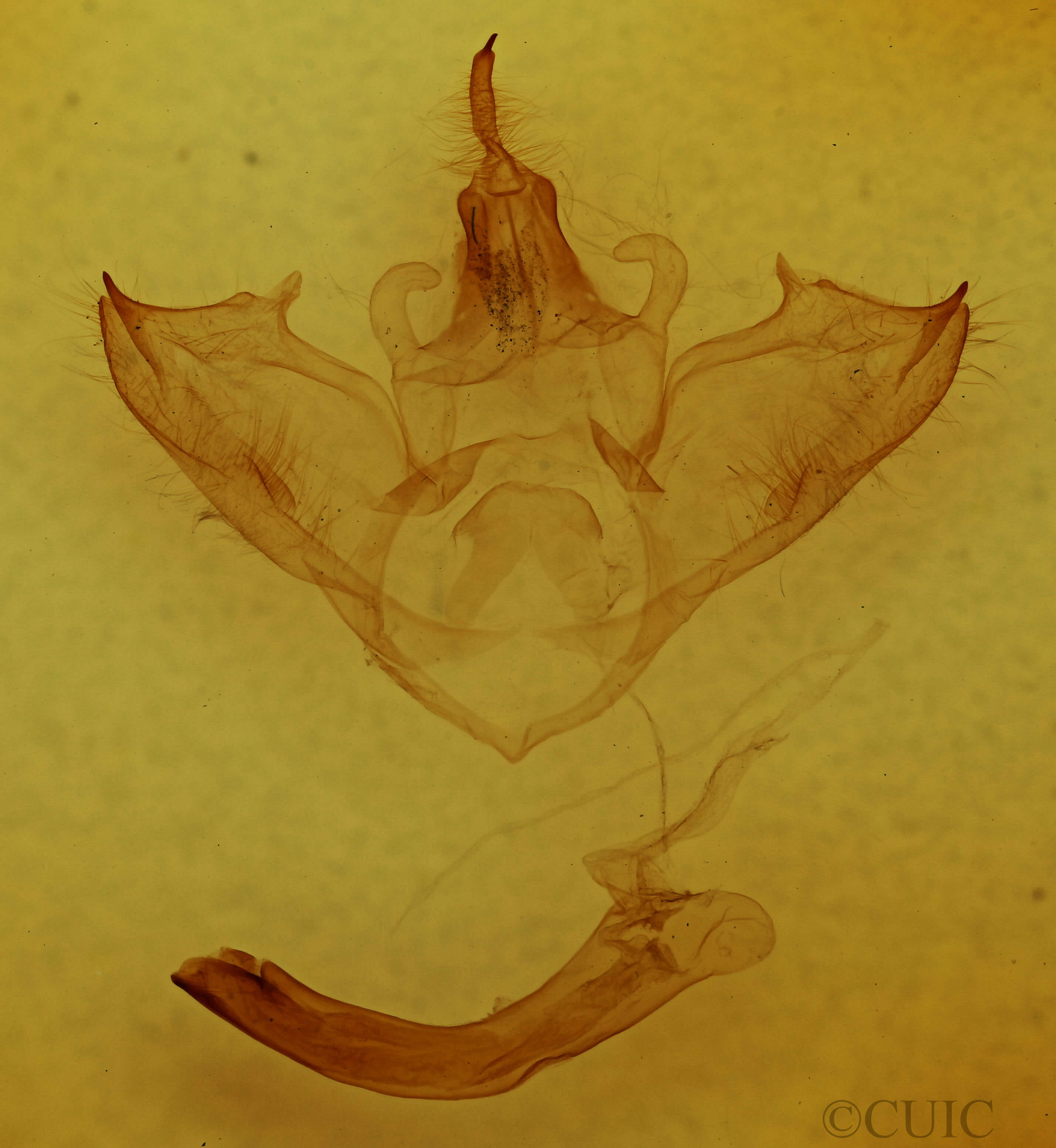 genitalia view of adult Halysidota tessellaris