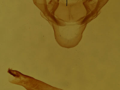 genitalia view of adult Hyphantria cunea