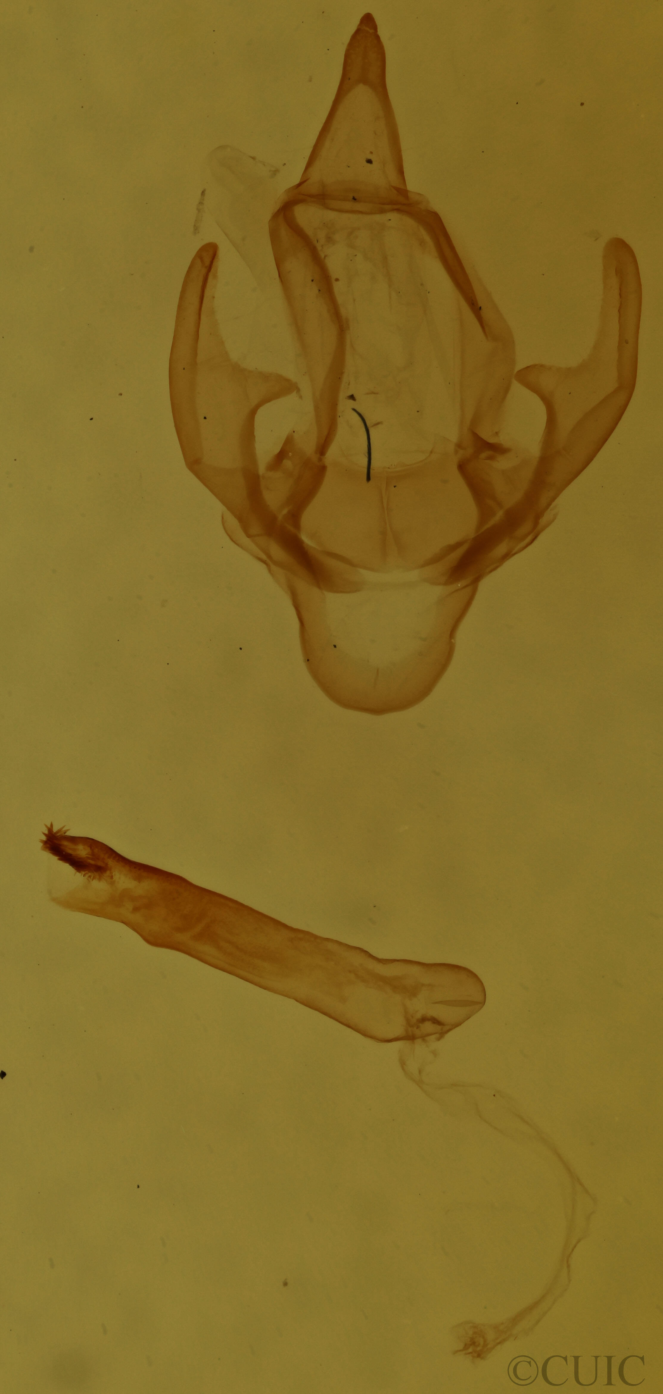 genitalia view of adult Hyphantria cunea