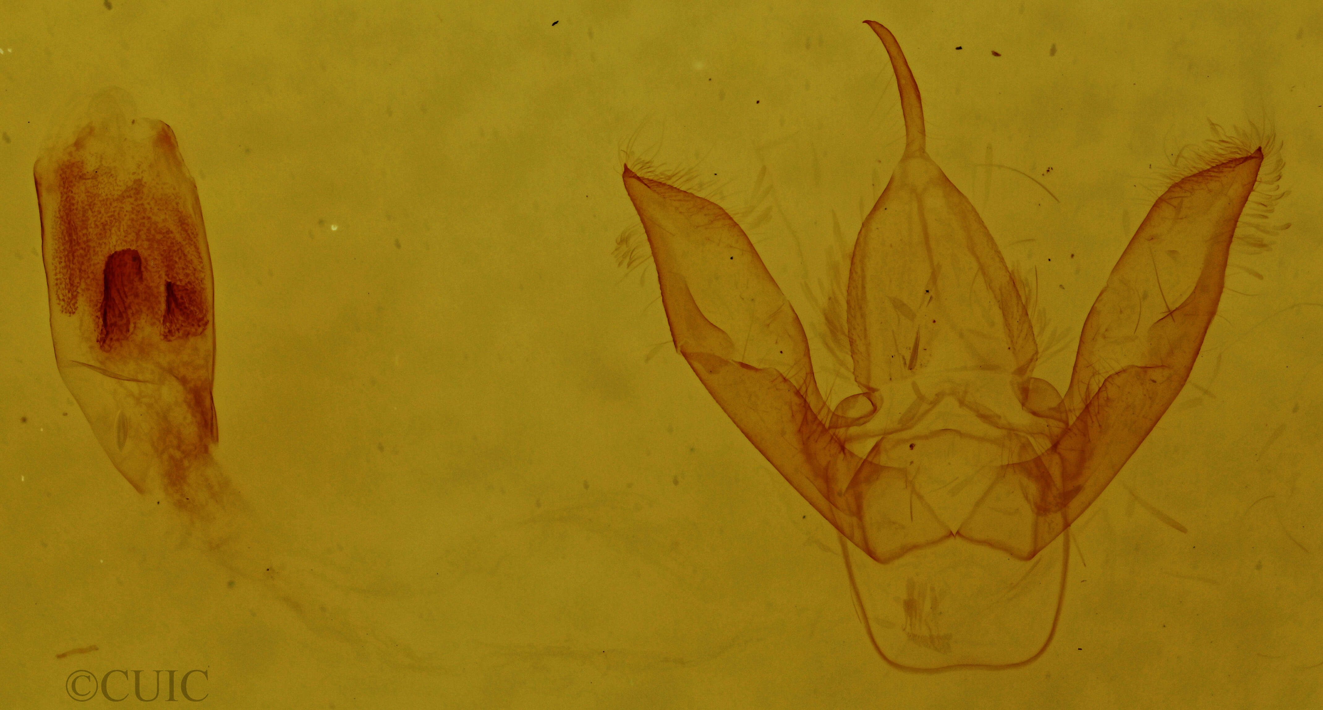 genitalia view of adult Hypoprepia miniata