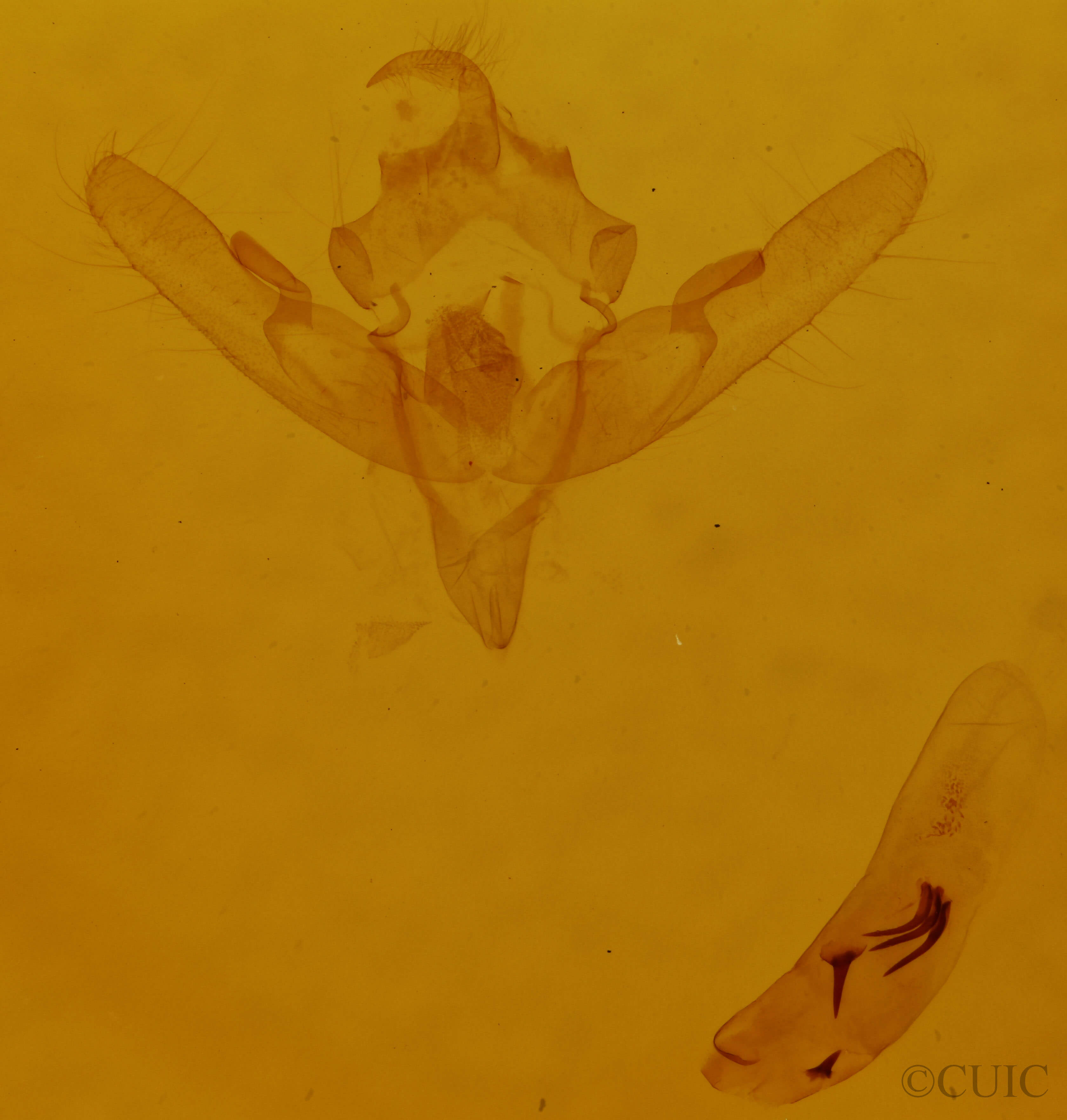 genitalia view of adult Leucochlaena oditis