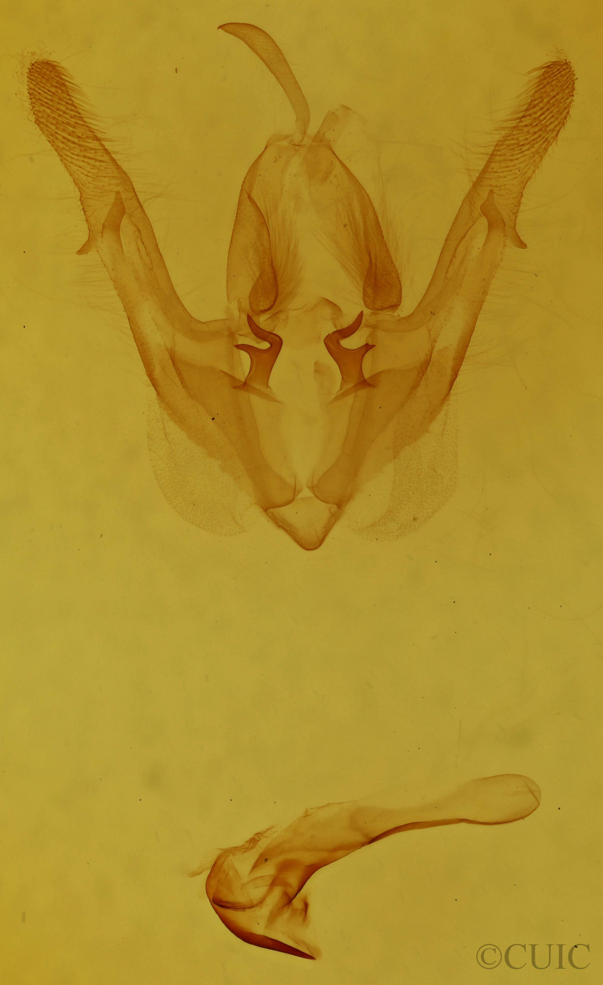 genitalia view of adult Licha undilinealis