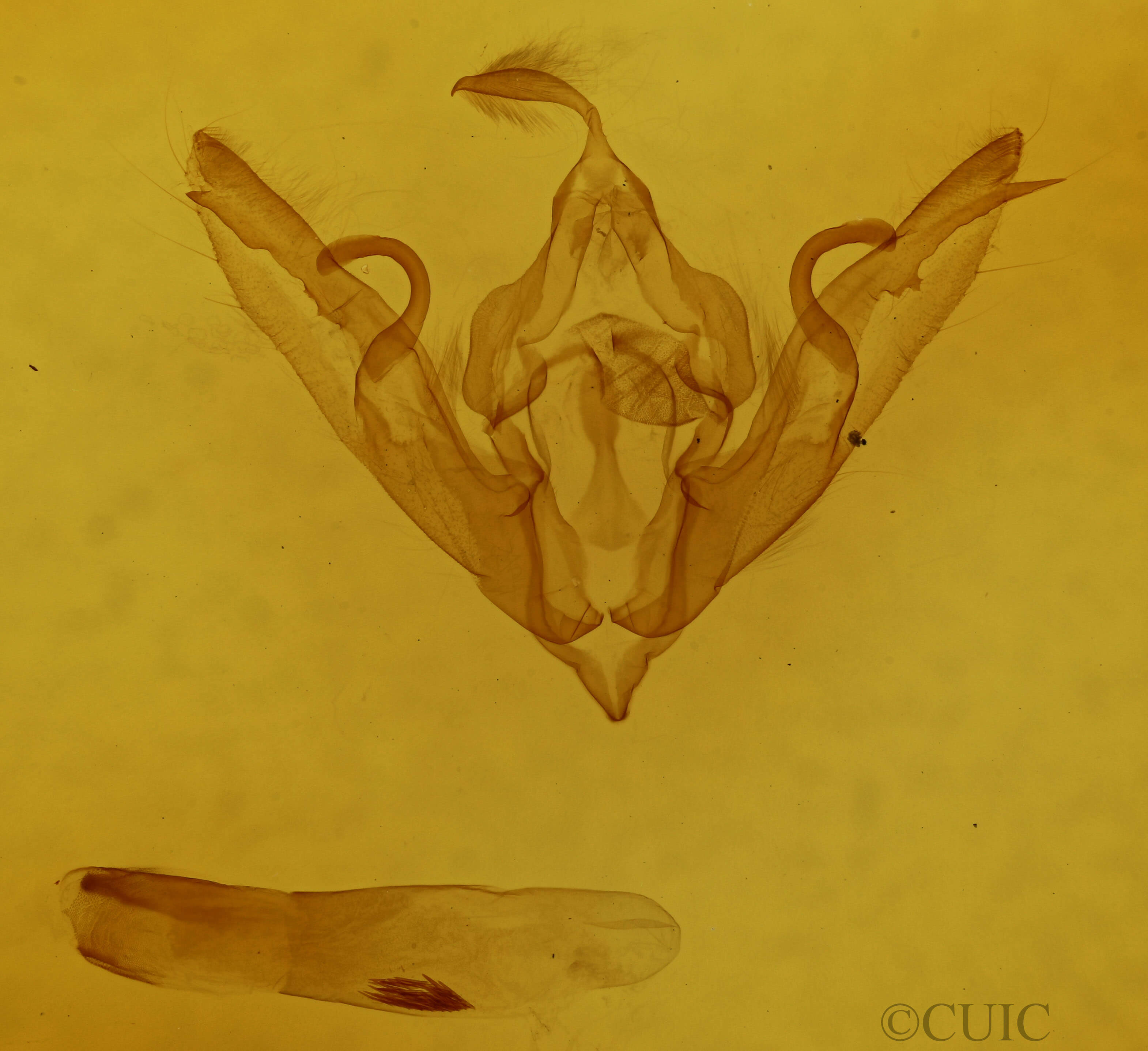 genitalia view of adult Lithophane patefacta