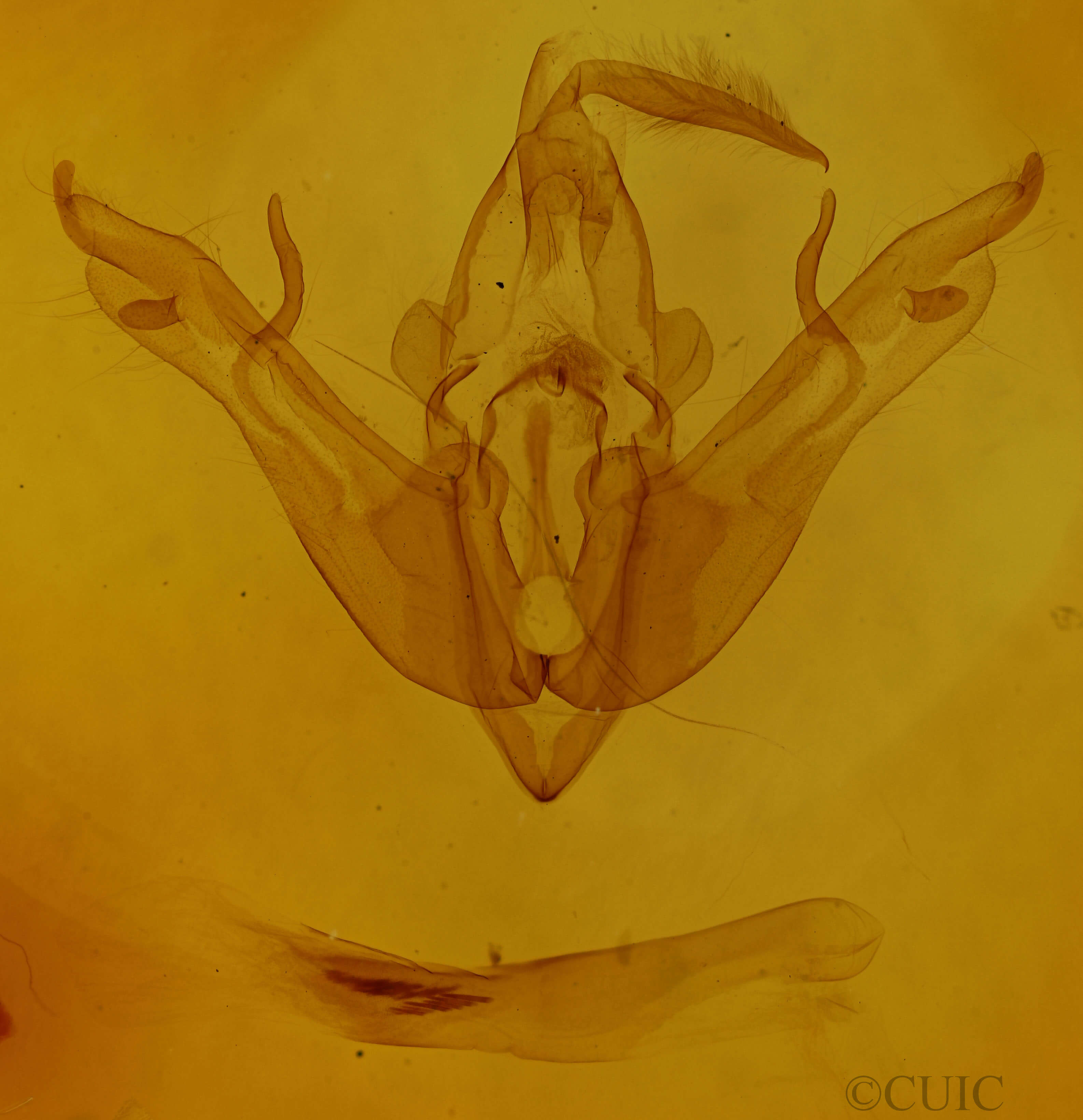 genitalia view of adult Lithophane semibrunnea