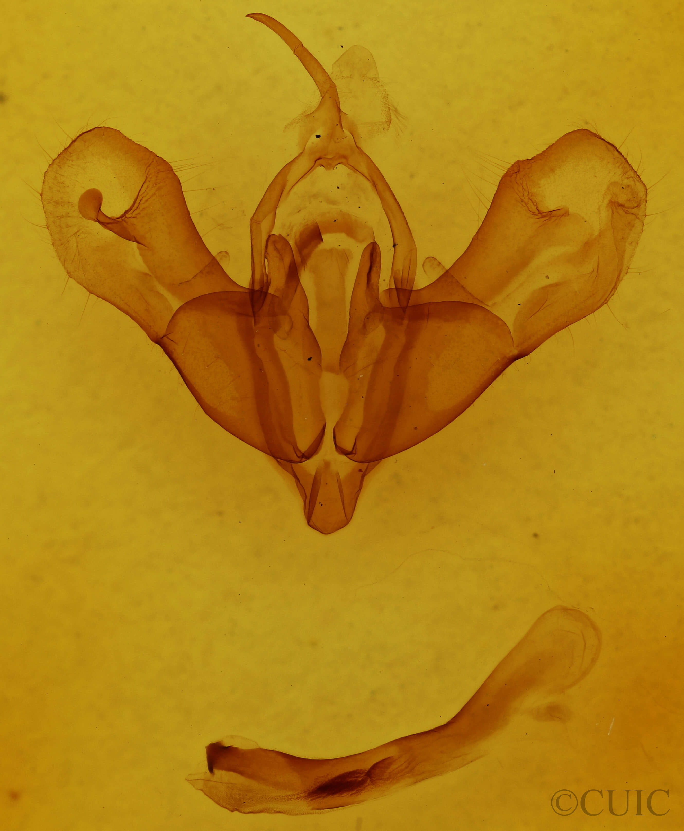 genitalia view of adult Metalopha liturata