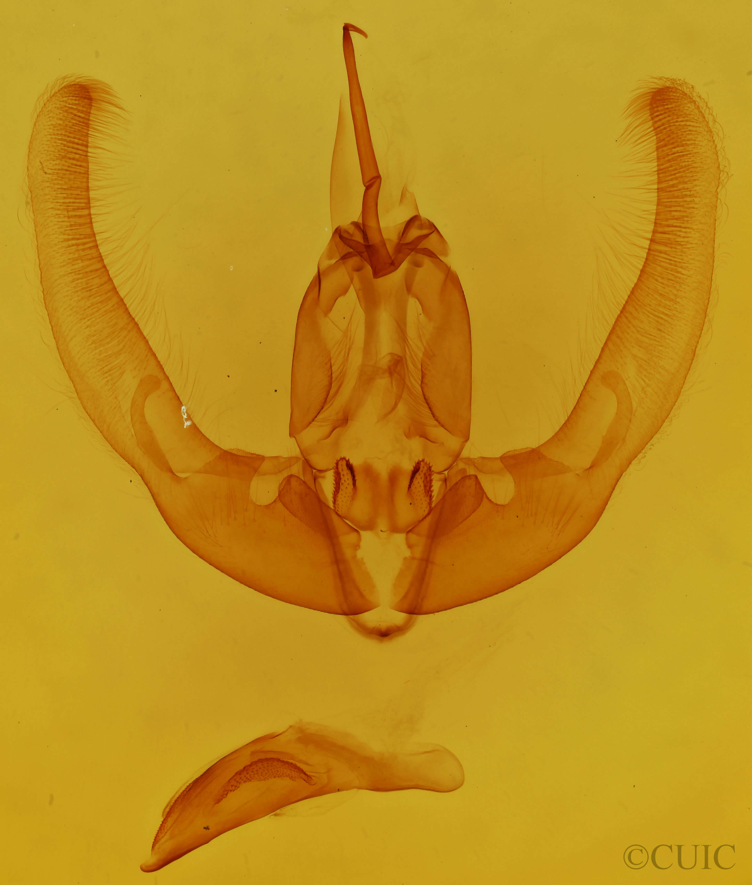 genitalia view of adult Condica imitata