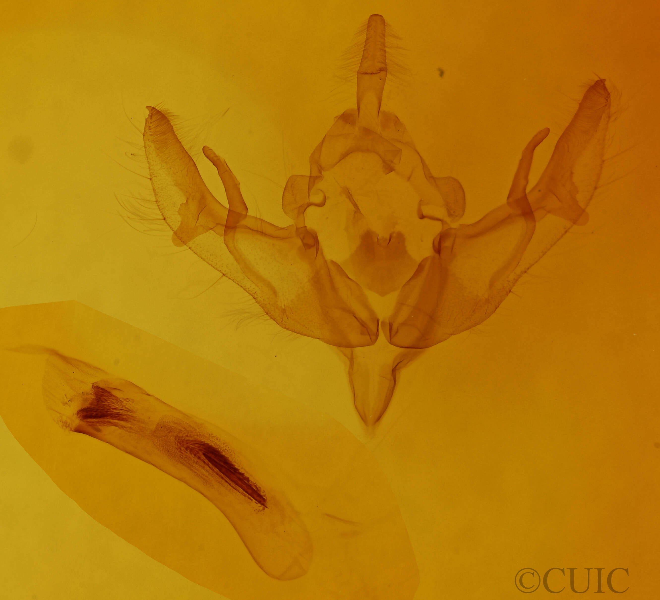 genitalia view of adult Omphaloscelis lunosa