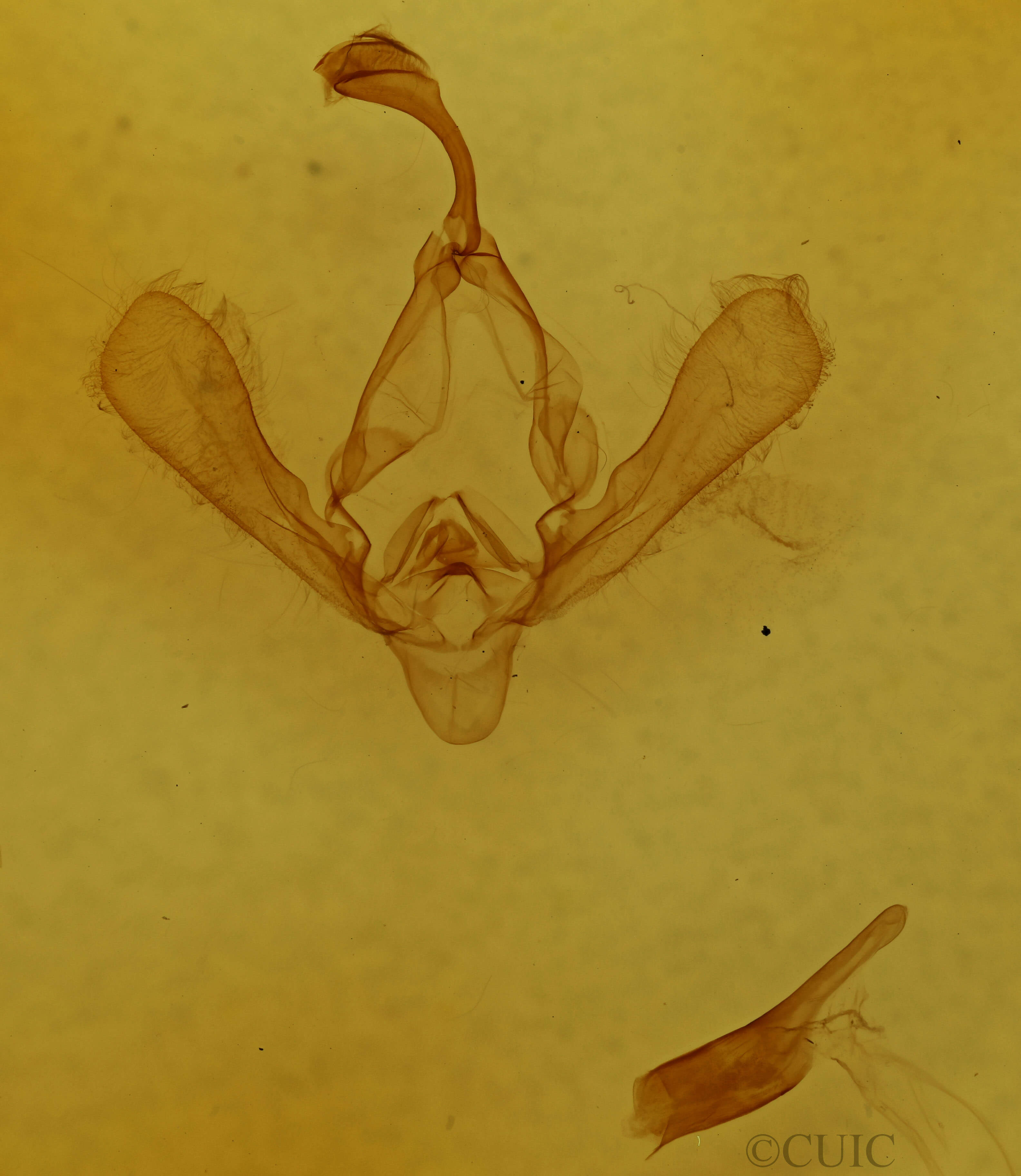genitalia view of adult Panopoda carneicosta