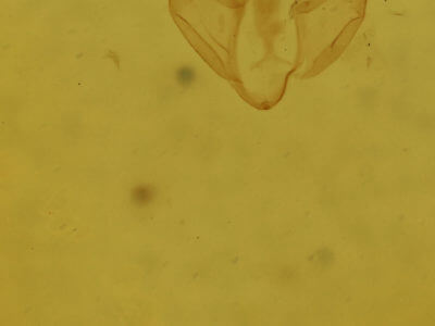 genitalia view of adult Parahypenodes quadralis