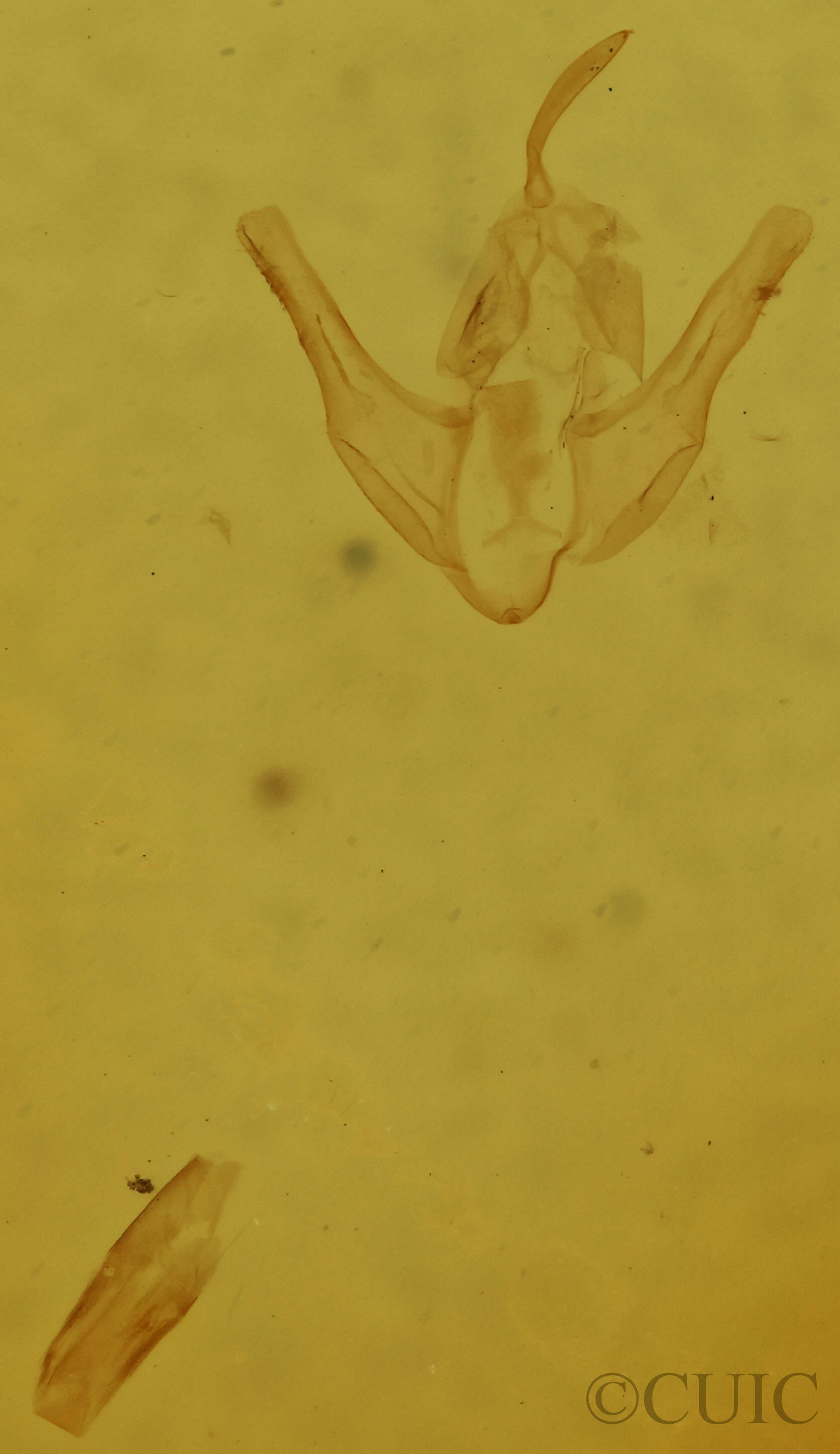 genitalia view of adult Parahypenodes quadralis