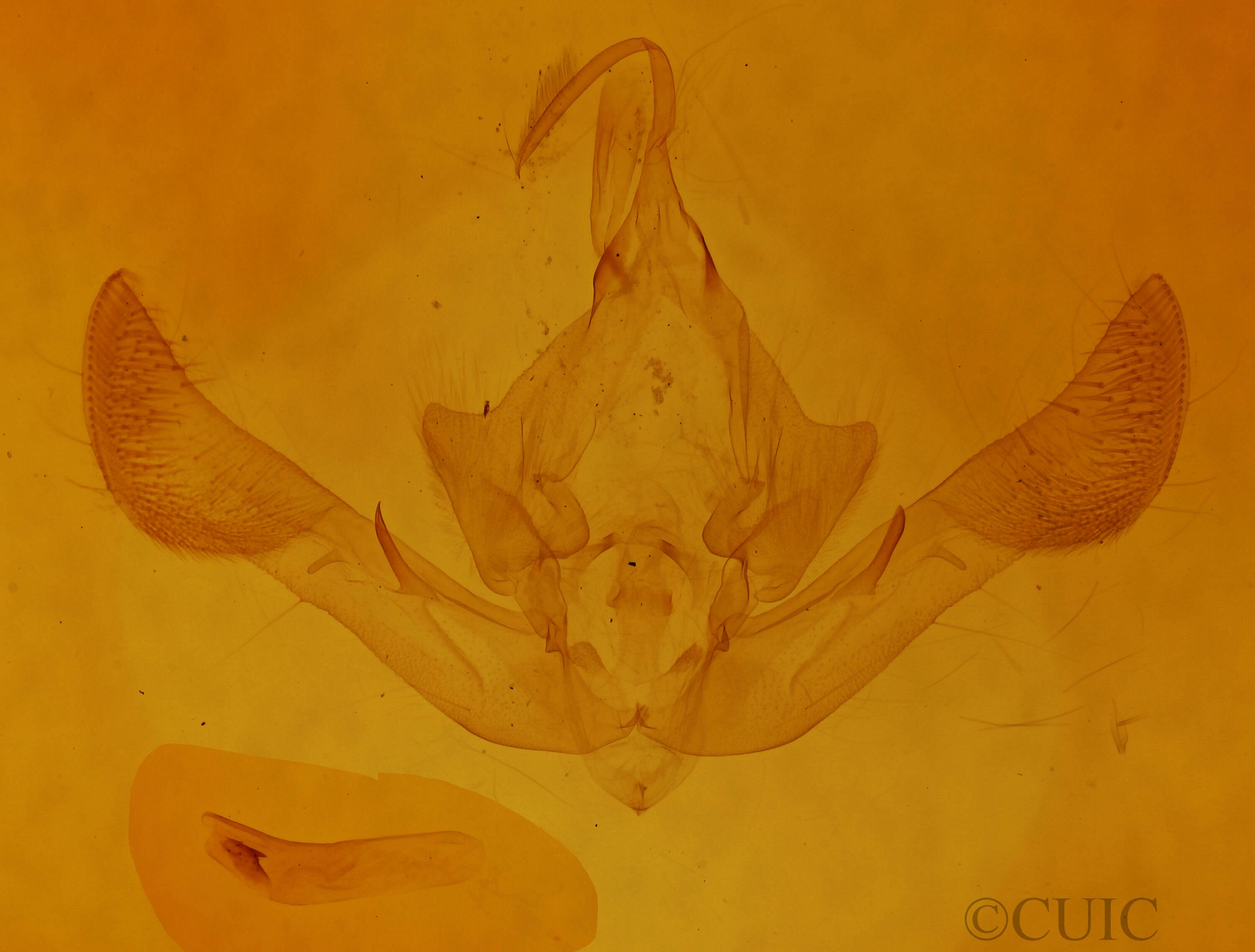genitalia view of adult Parastichtis suspecta