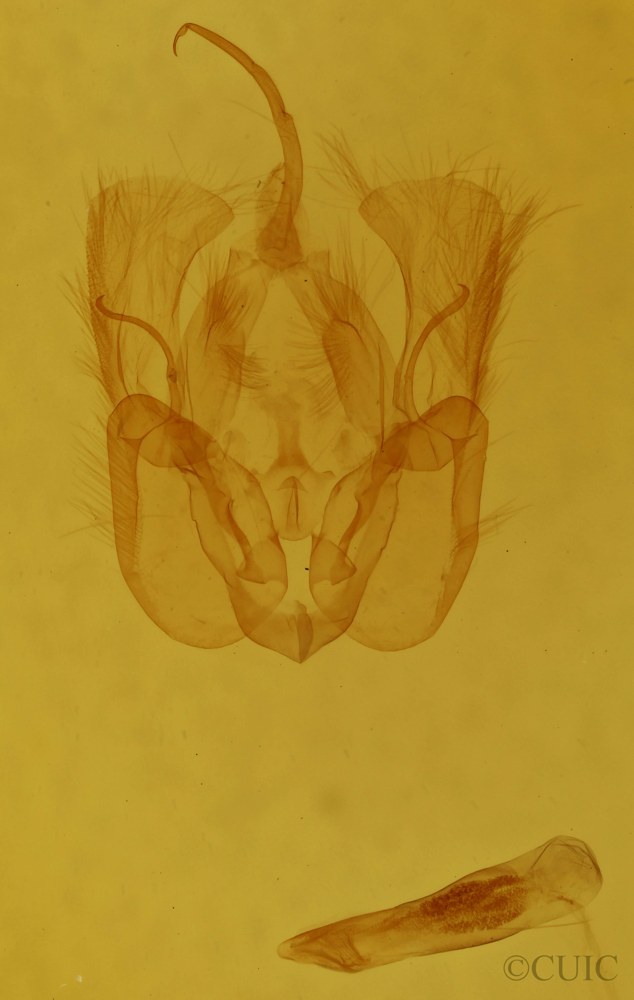genitalia view of adult Perigea xanthioides
