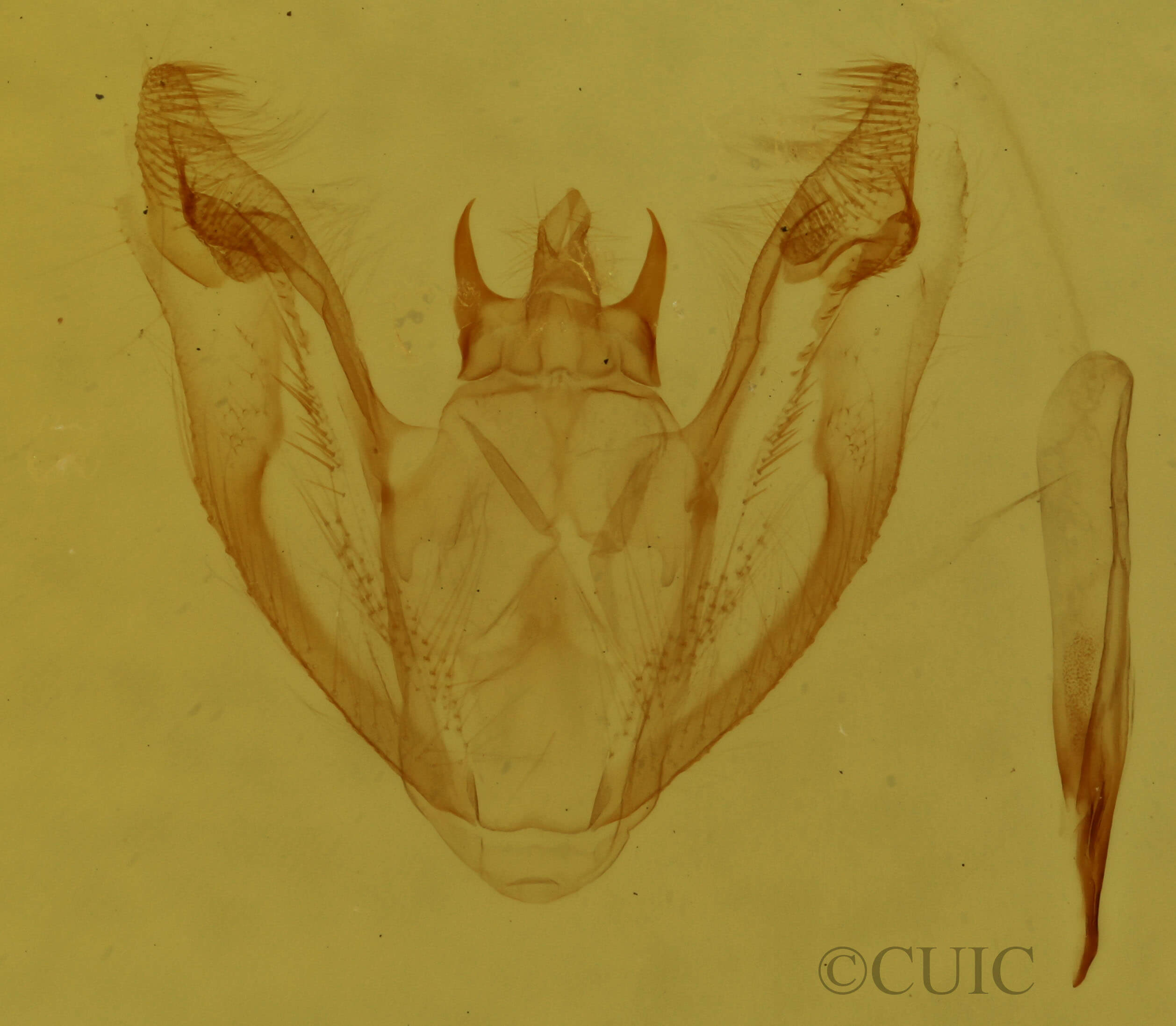 genitalia view of adult Protoboarmia porcelaria