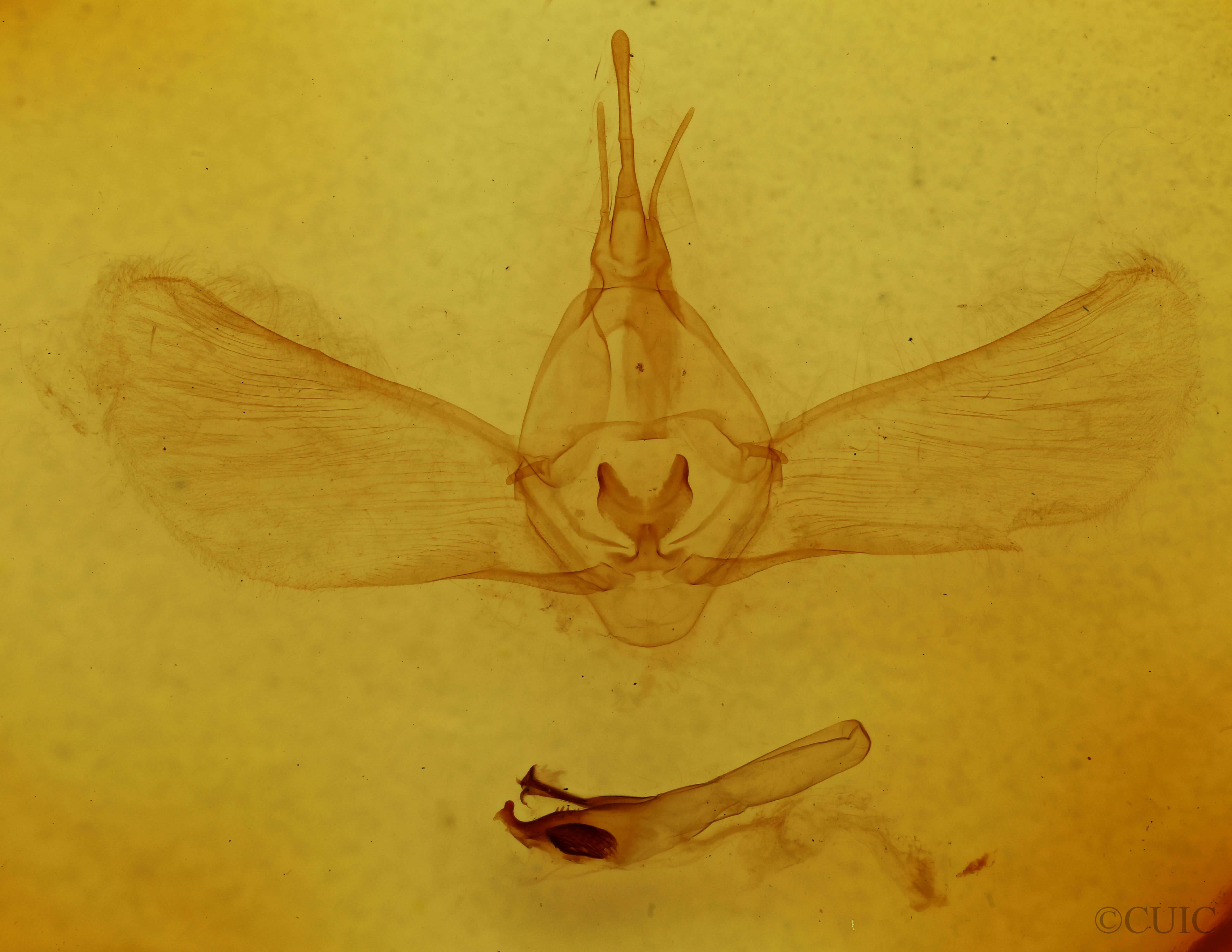 genitalia view of adult Pseudothyatira cymatophoroides